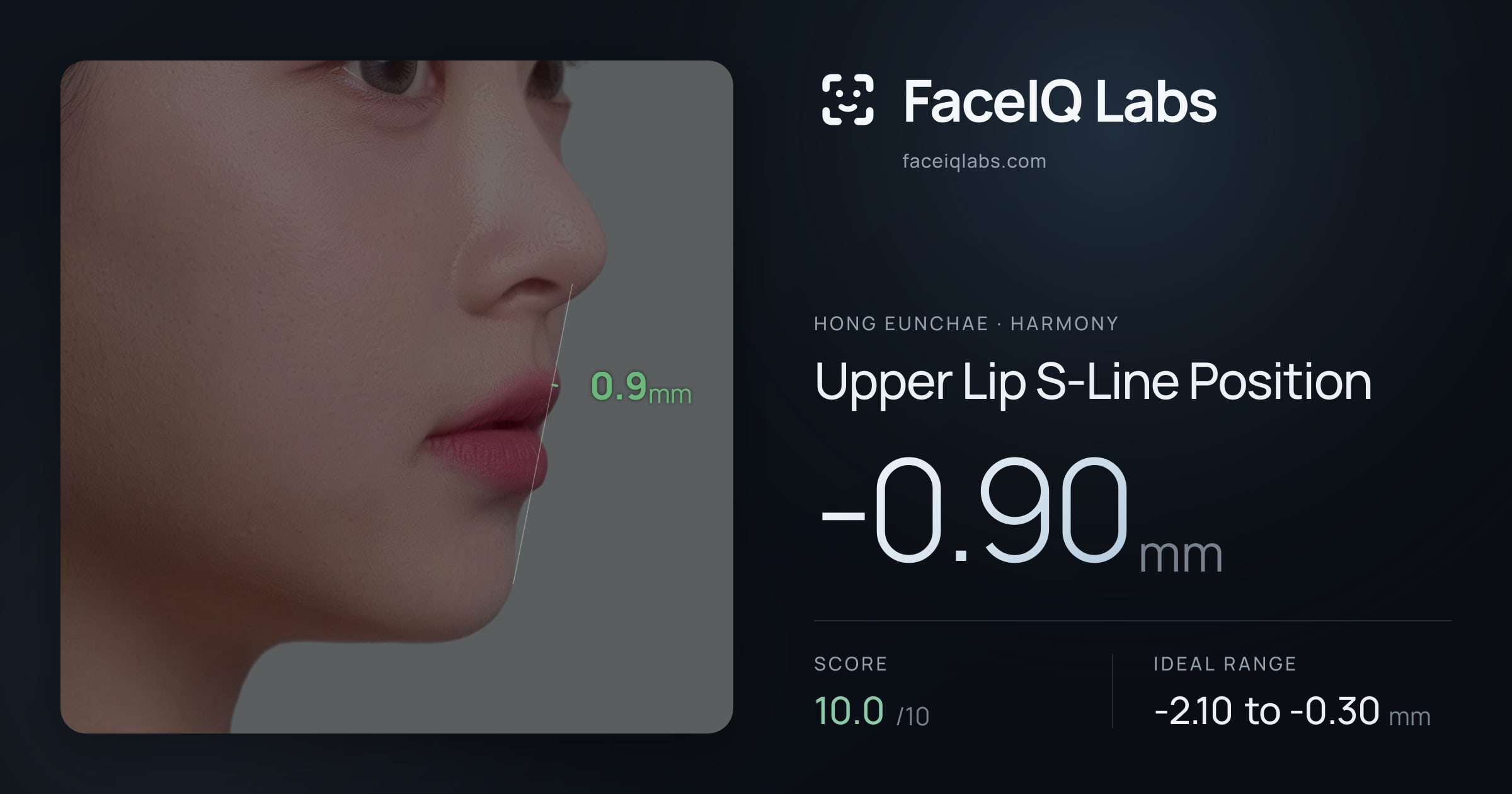 Hong Eunchae Upper Lip S-Line Position: -0.90mm, drawn on the photo