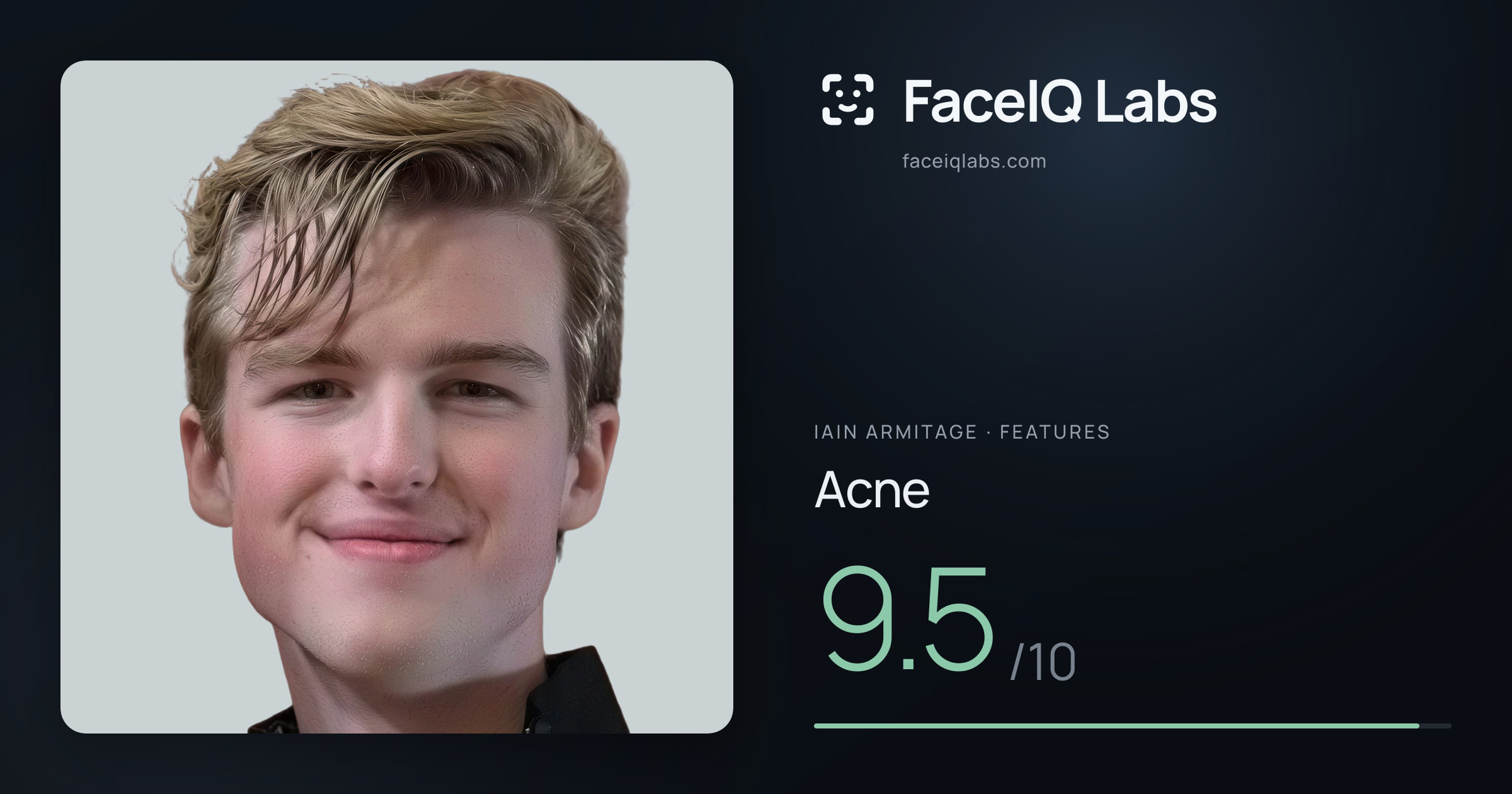 Iain Armitage Acne: 9.5/10, drawn on the photo