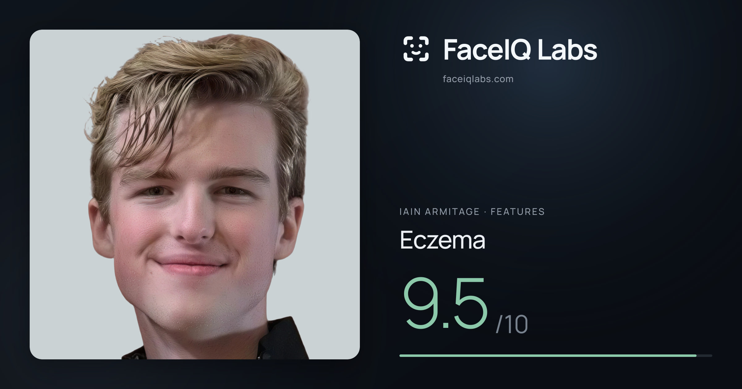 Iain Armitage Eczema: 9.5/10, drawn on the photo