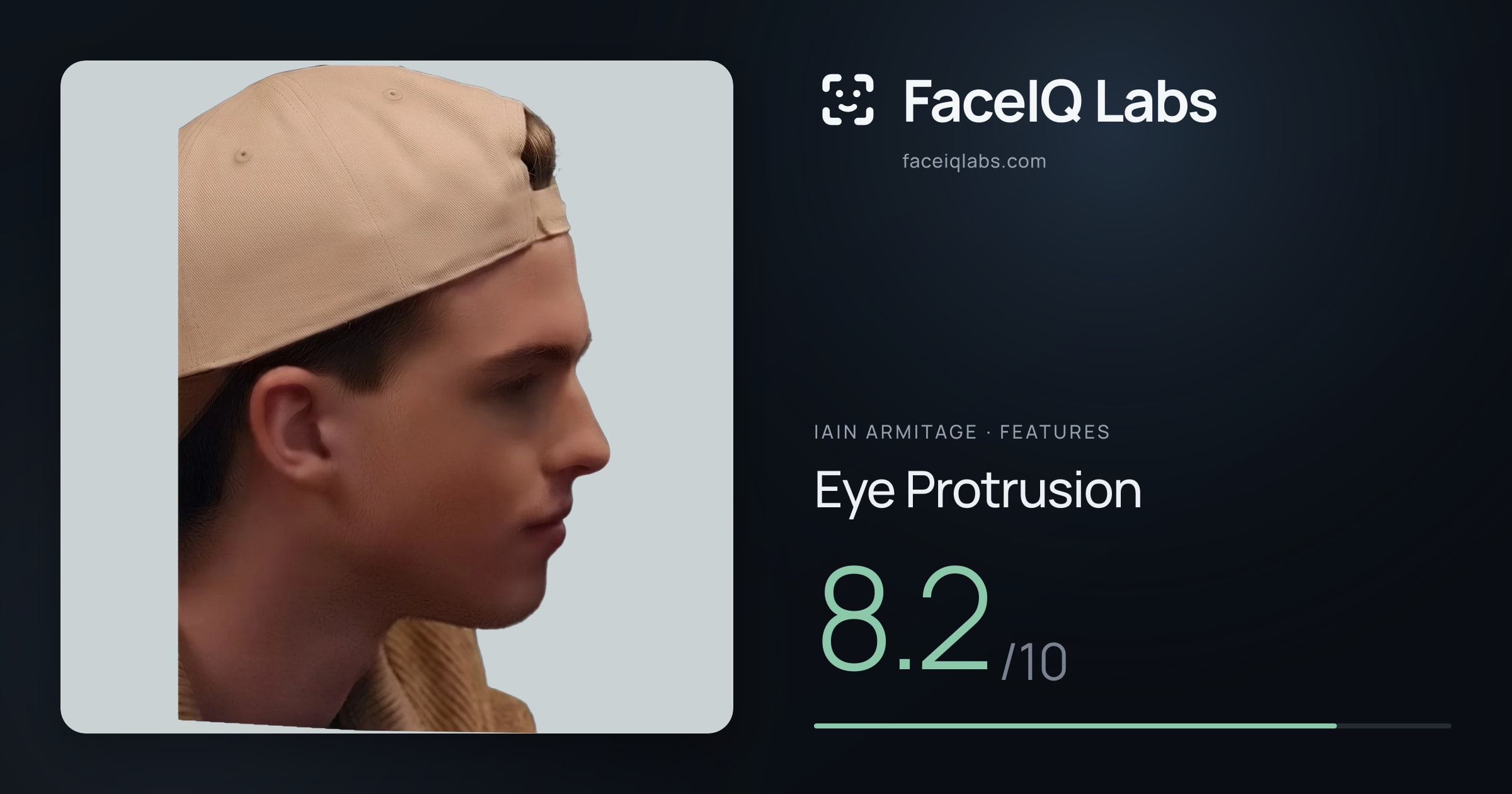 Iain Armitage Eye Protrusion: 8.2/10, drawn on the photo