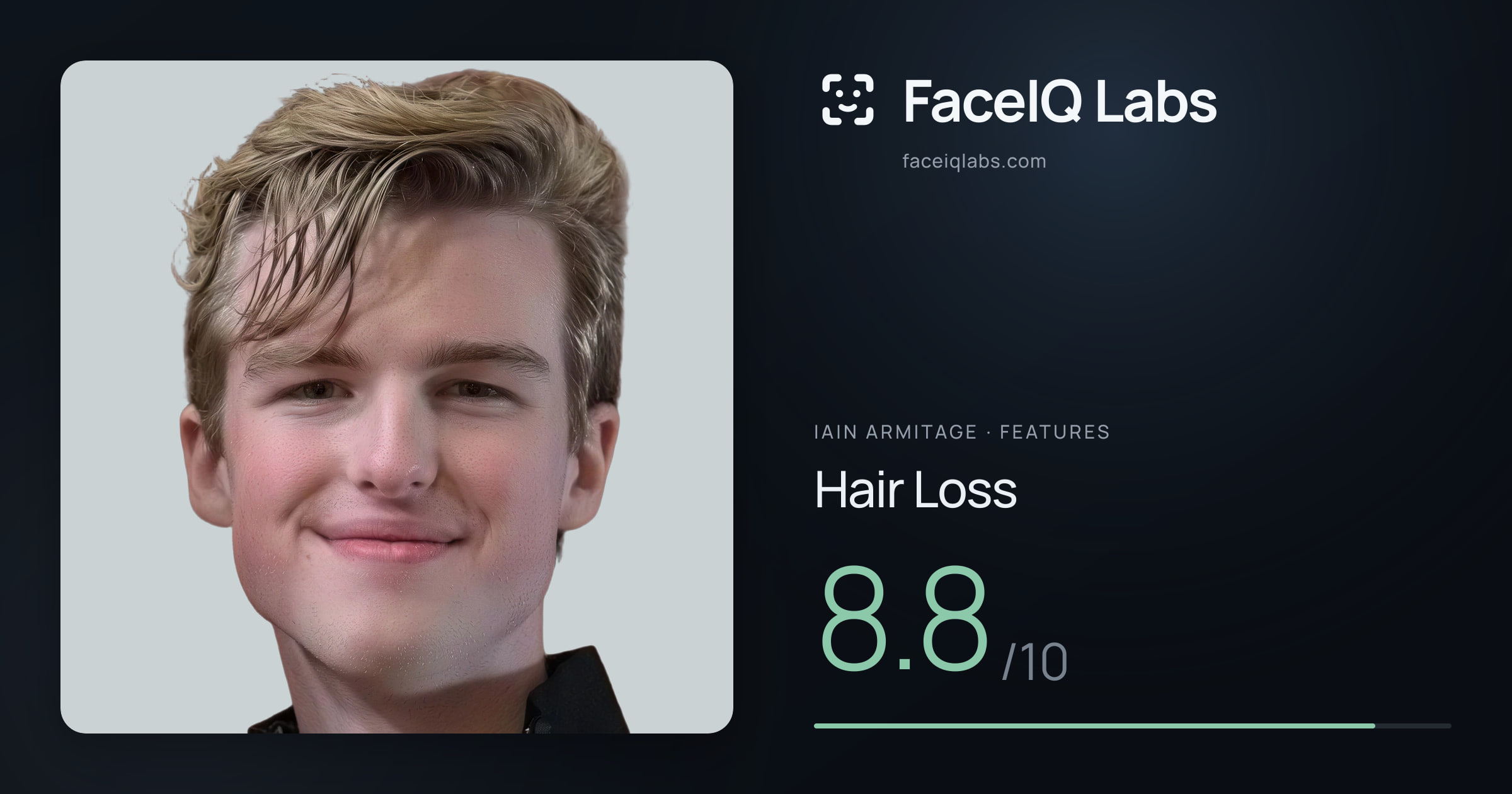 Iain Armitage Hair Loss: 8.8/10, drawn on the photo