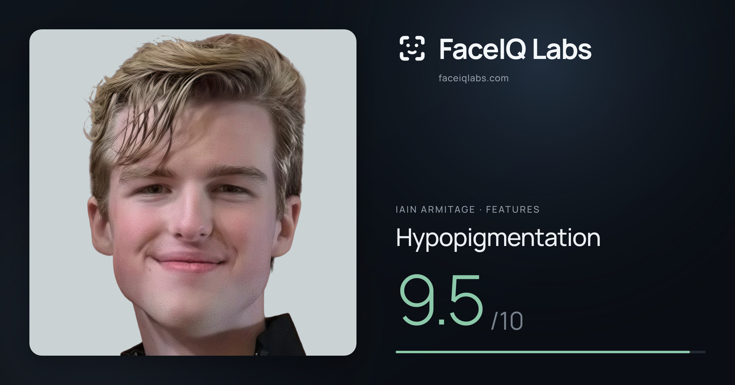 Iain Armitage Hypopigmentation: 9.5/10, drawn on the photo