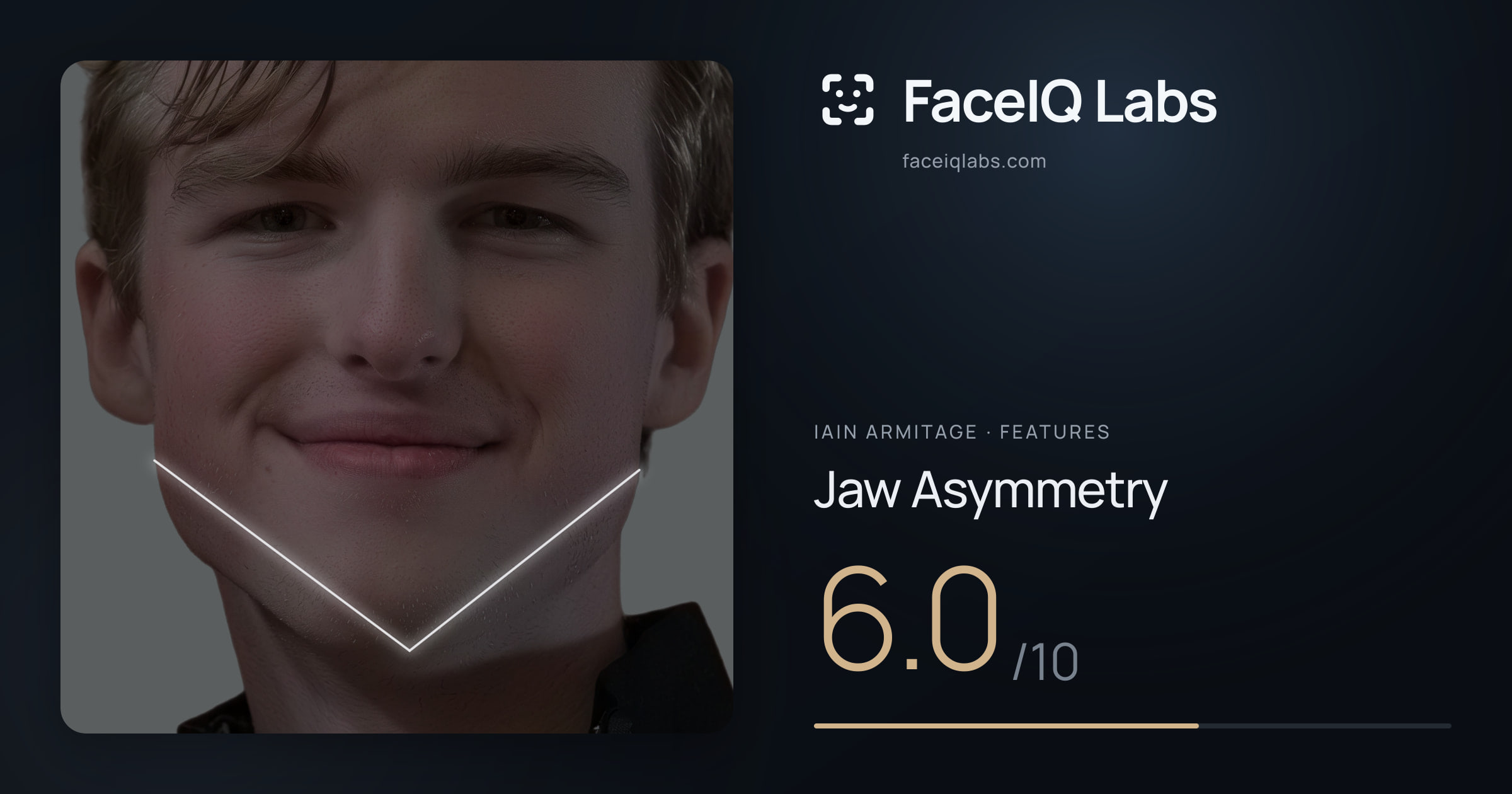 Iain Armitage Jaw Asymmetry: 6.0/10, drawn on the photo