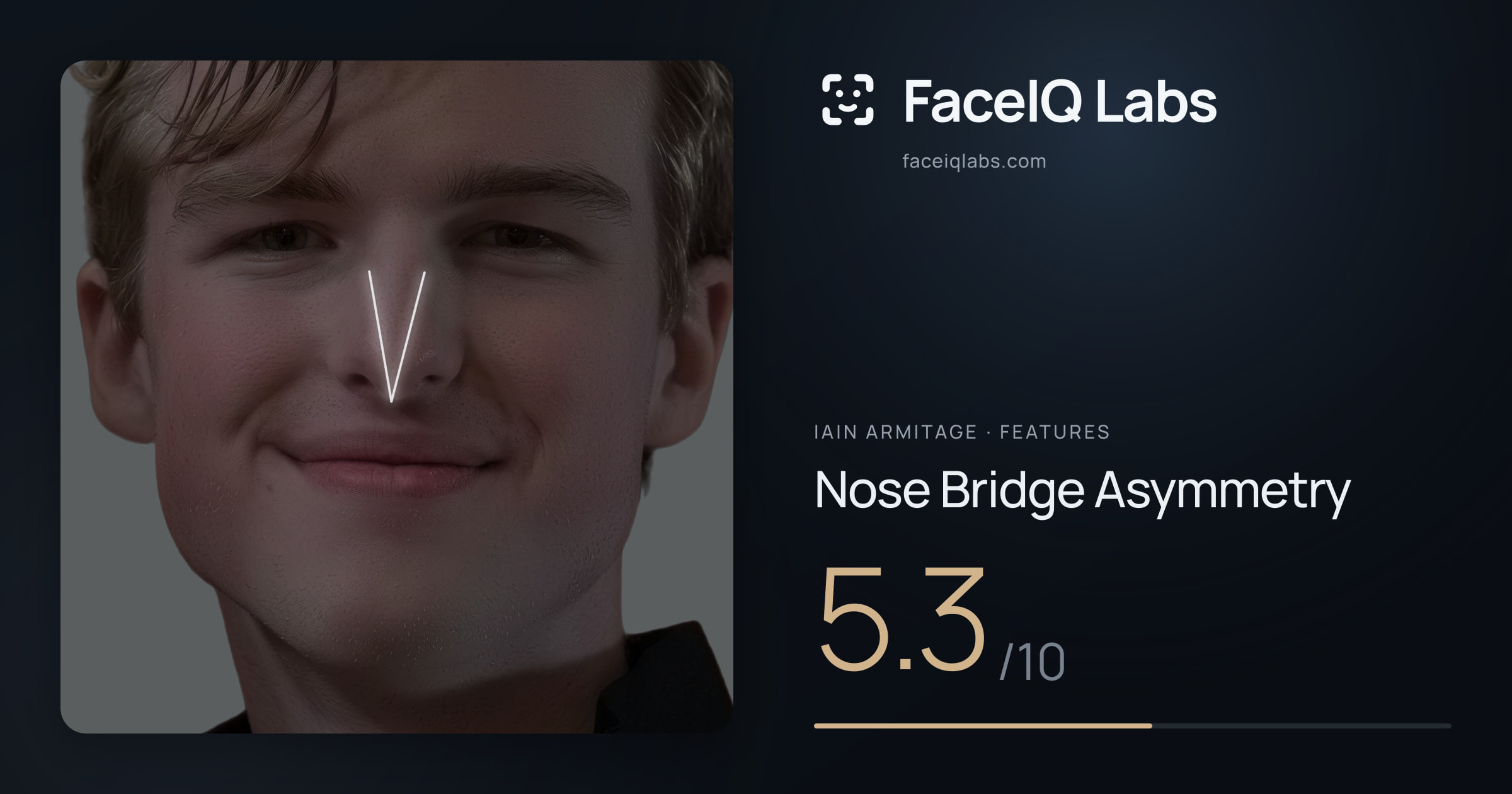 Iain Armitage Nose Bridge Asymmetry: 5.3/10, drawn on the photo