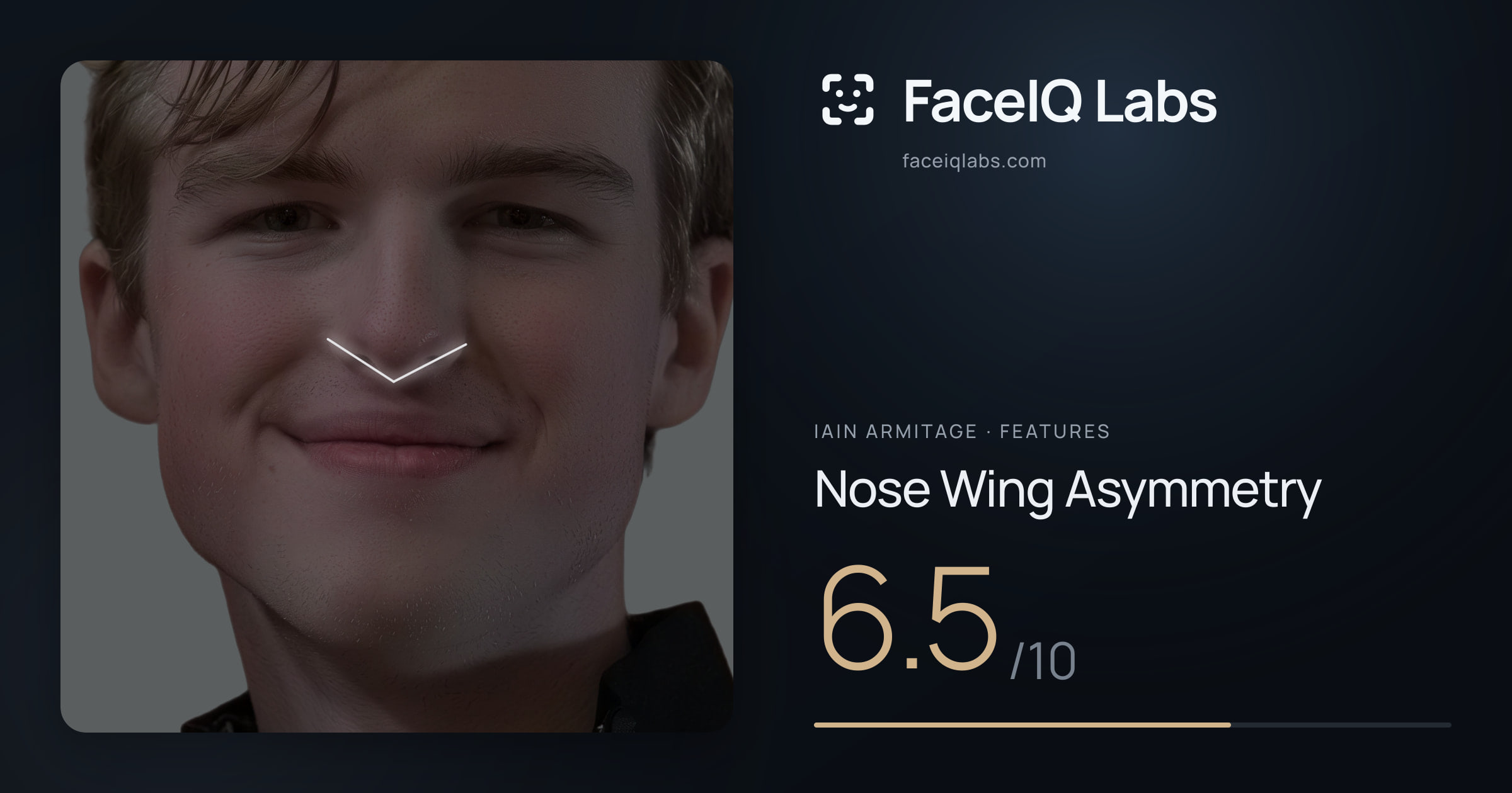 Iain Armitage Nose Wing Asymmetry: 6.5/10, drawn on the photo