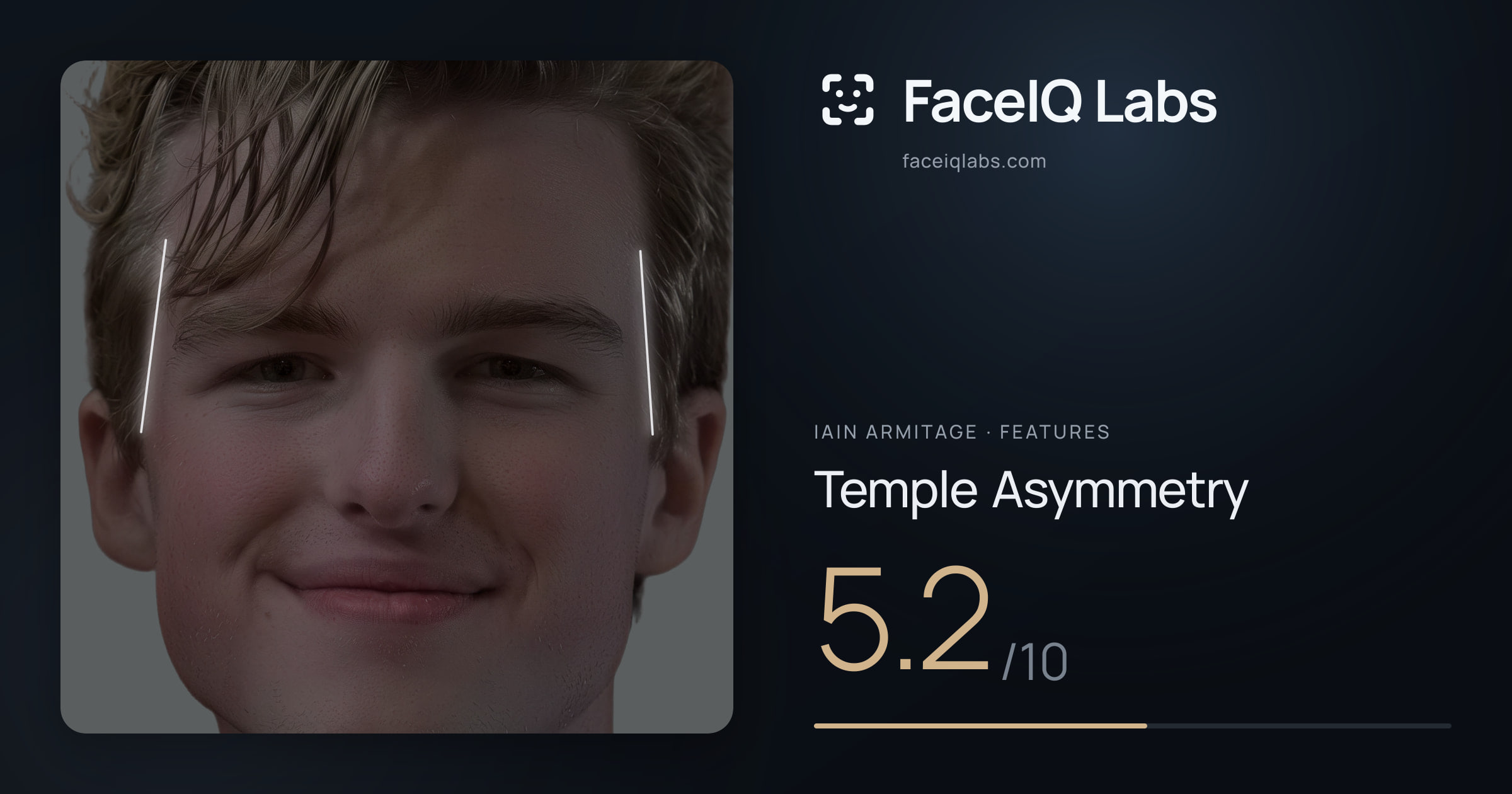 Iain Armitage Temple Asymmetry: 5.2/10, drawn on the photo