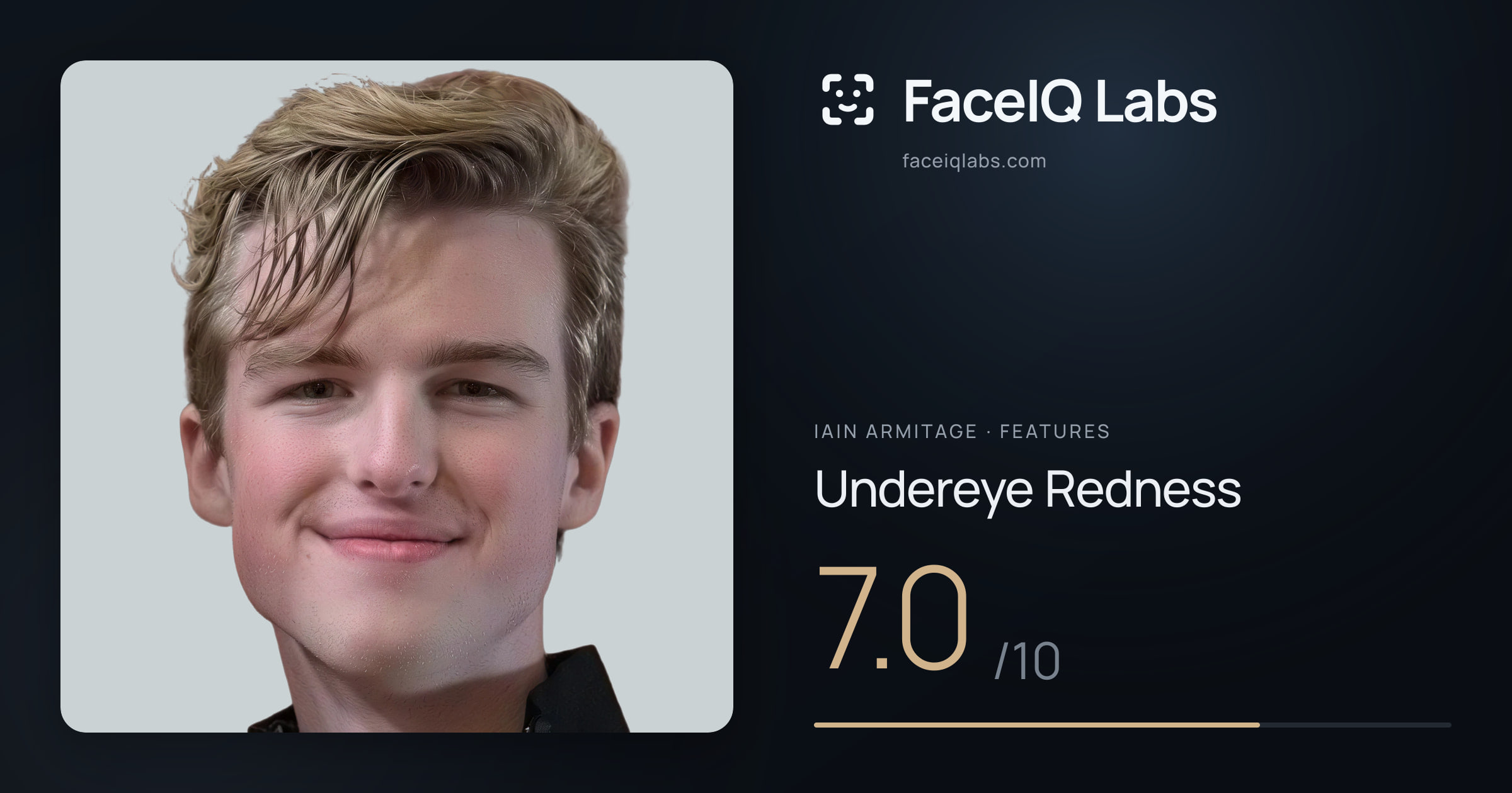 Iain Armitage Undereye Redness: 7.0/10, drawn on the photo