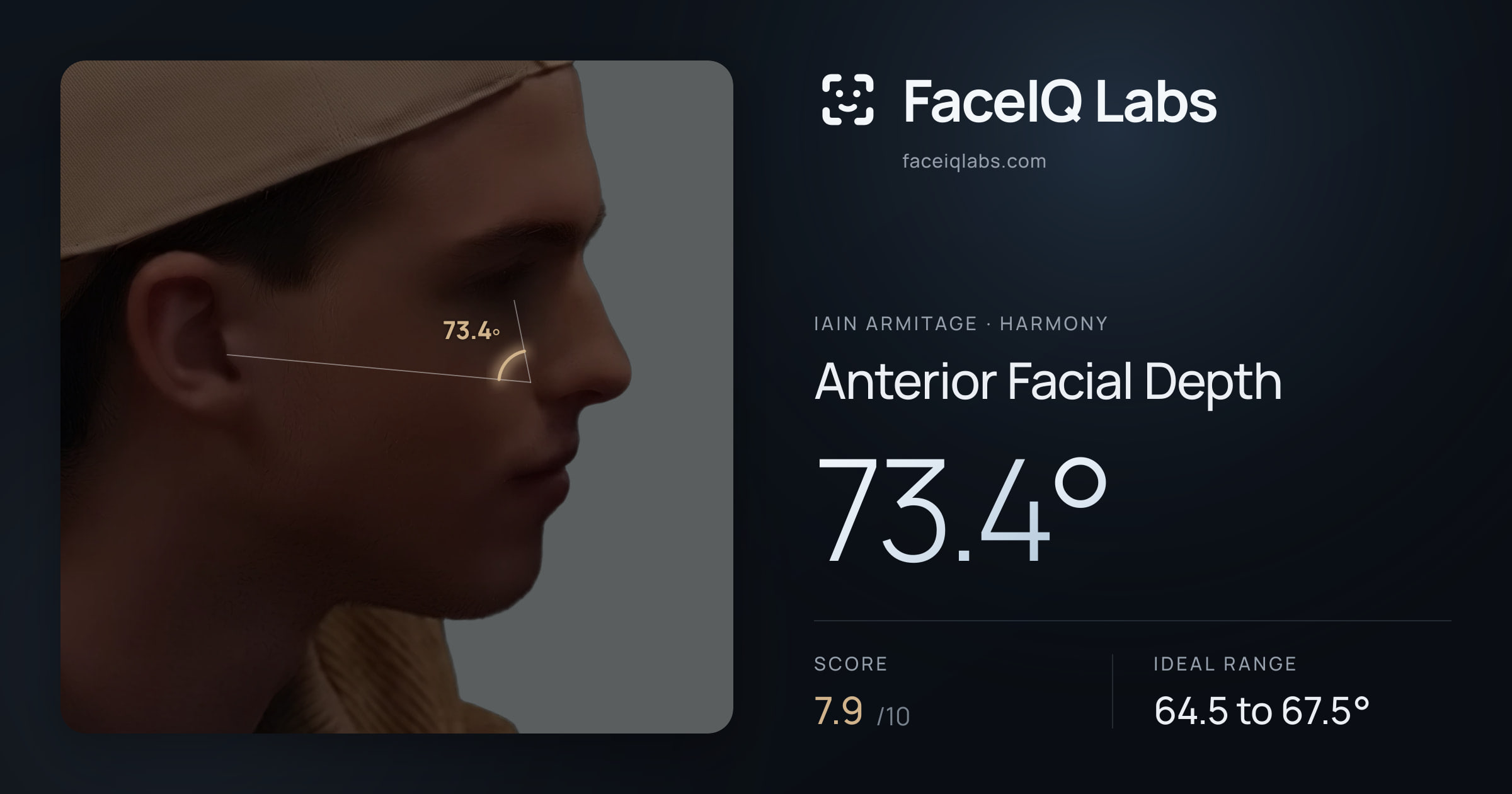 Iain Armitage Anterior Facial Depth: 73.4°, drawn on the photo