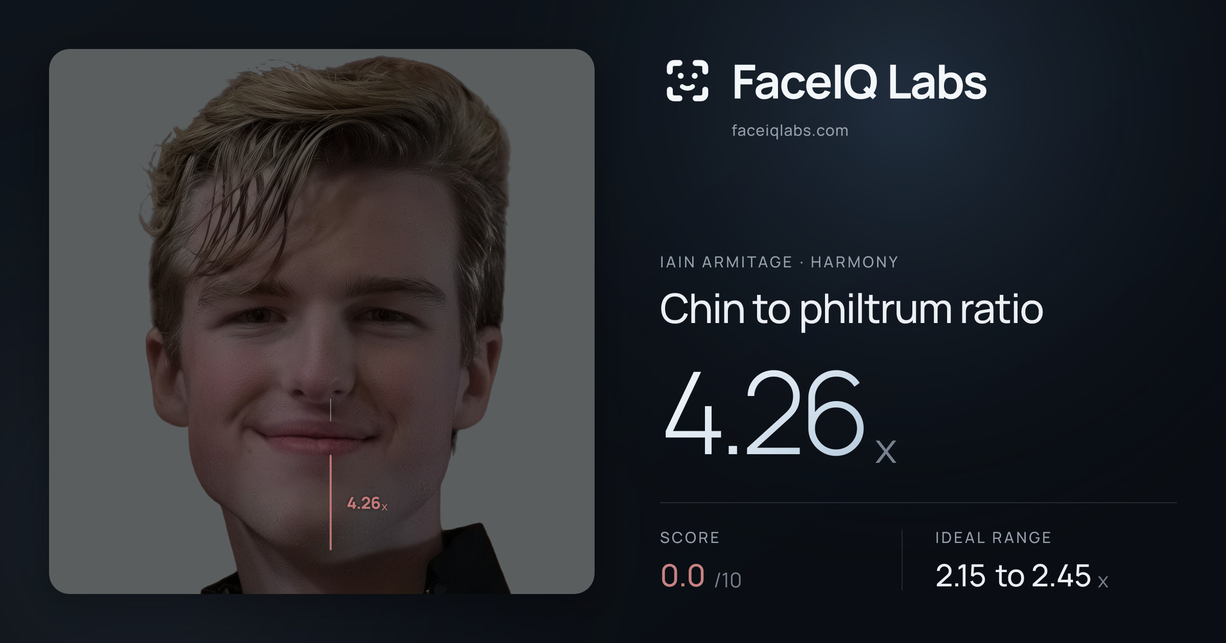 Iain Armitage Chin to philtrum ratio: 4.26x, drawn on the photo