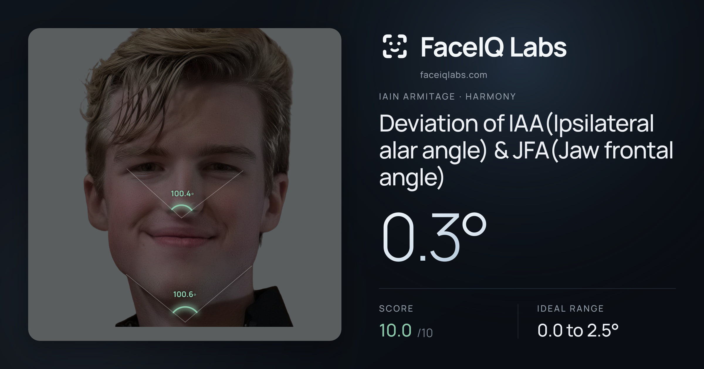 Iain Armitage Deviation of IAA(Ipsilateral alar angle) & JFA(Jaw frontal angle): 0.3°, drawn on the photo