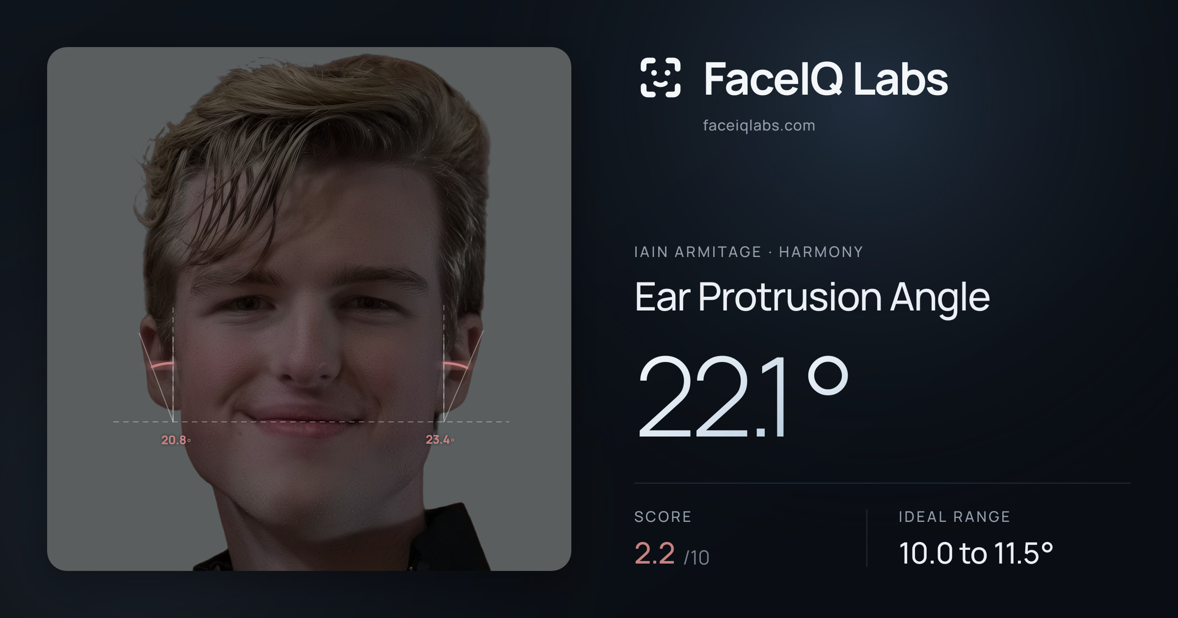 Iain Armitage Ear Protrusion Angle: 22.1°, drawn on the photo