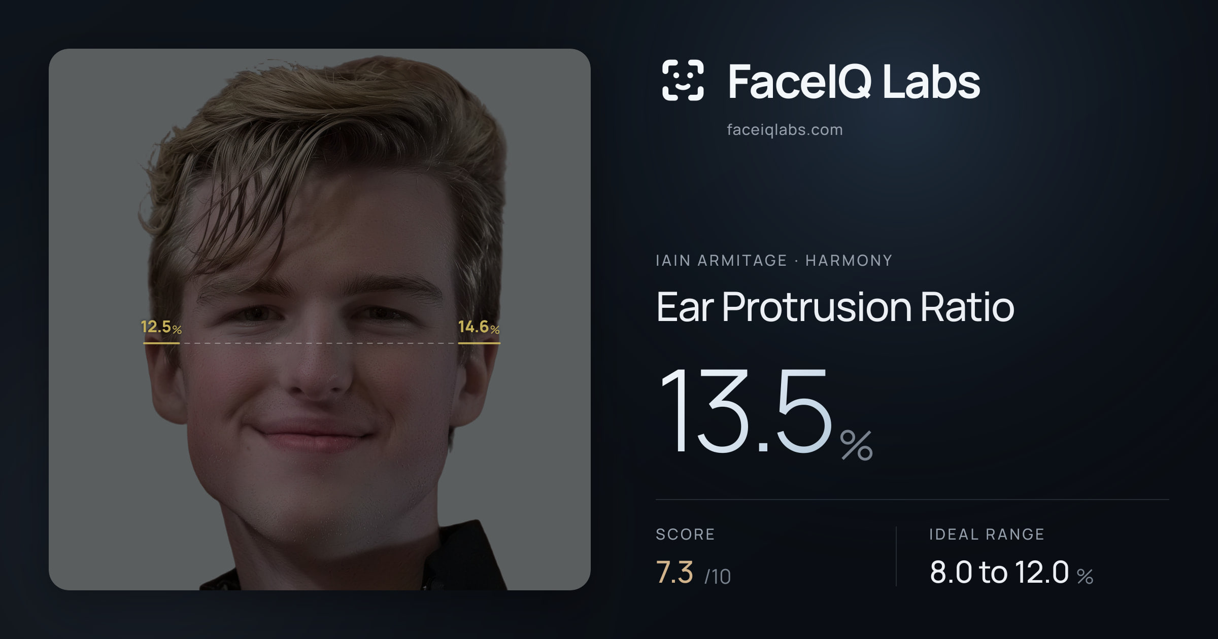 Iain Armitage Ear Protrusion Ratio: 13.5%, drawn on the photo