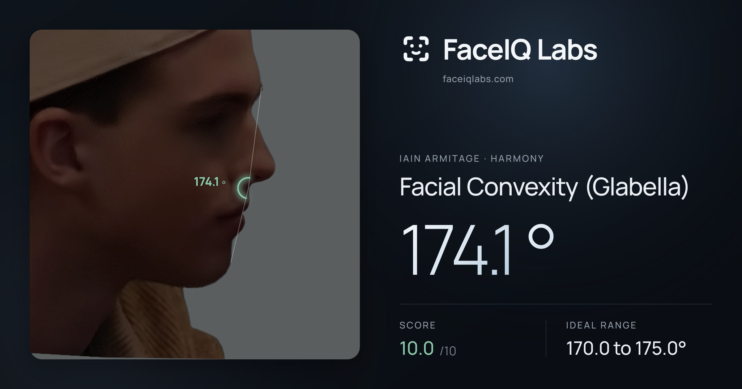Iain Armitage Facial Convexity (Glabella): 174.1°, drawn on the photo