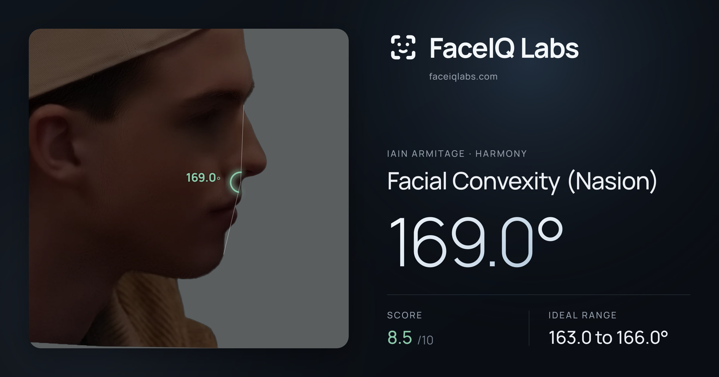 Iain Armitage Facial Convexity (Nasion): 169.0°, drawn on the photo