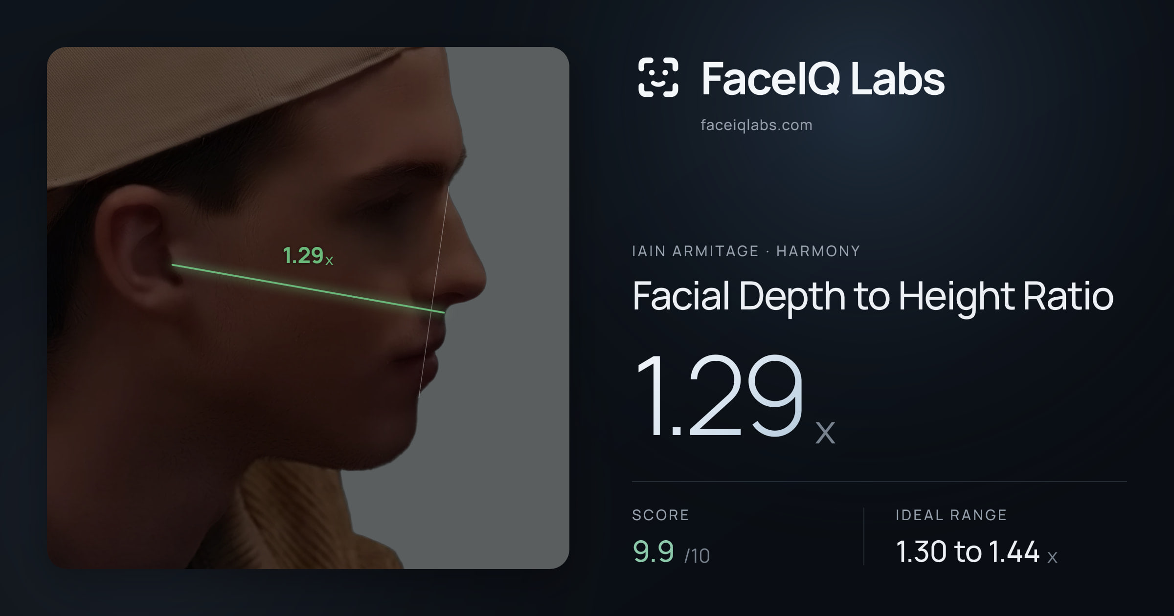 Iain Armitage Facial Depth to Height Ratio: 1.29x, drawn on the photo