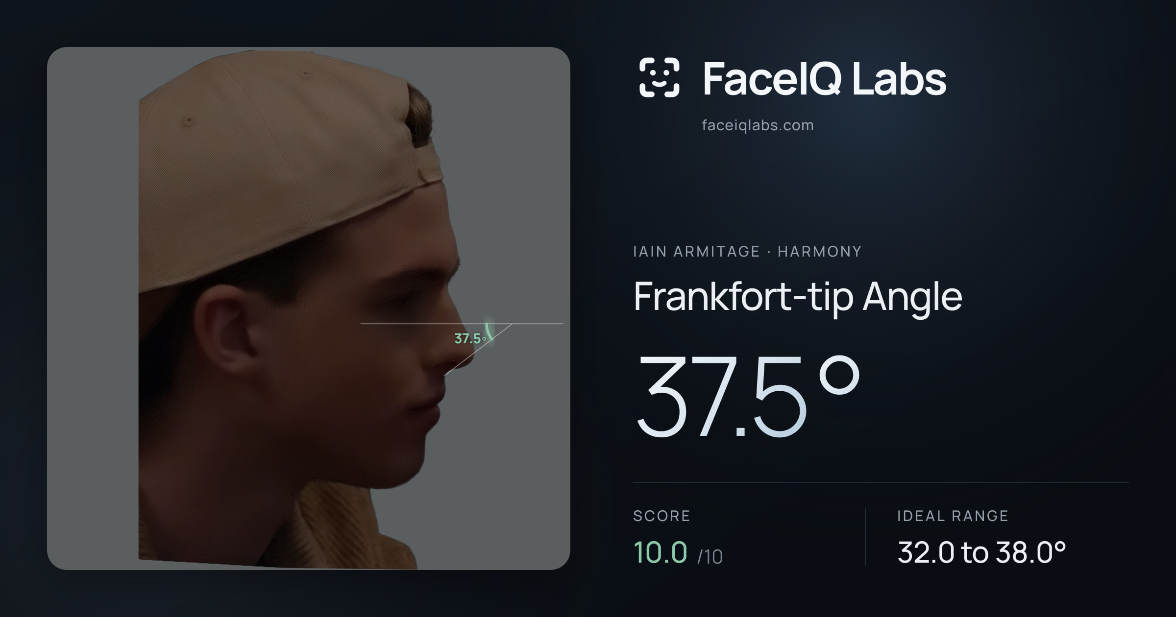 Iain Armitage Frankfort-tip Angle: 37.5°, drawn on the photo