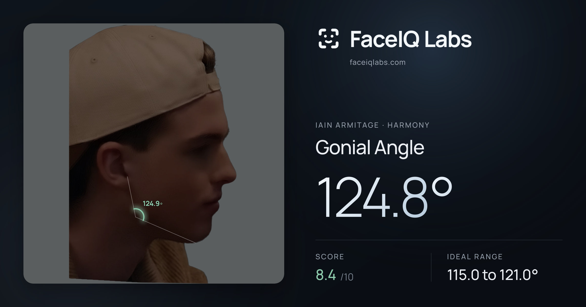 Iain Armitage Gonial Angle: 124.8°, drawn on the photo