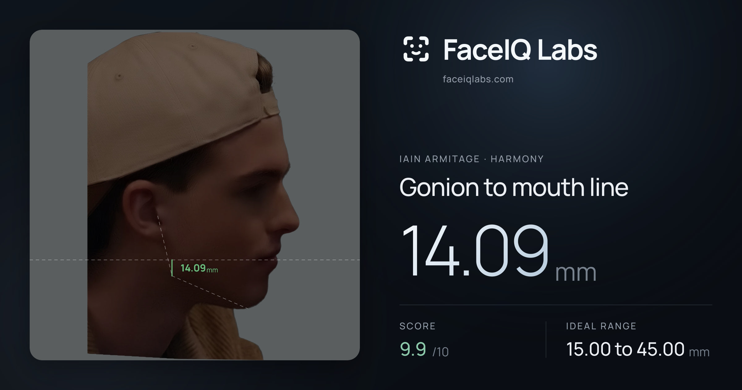 Iain Armitage Gonion to mouth line: 14.09mm, drawn on the photo