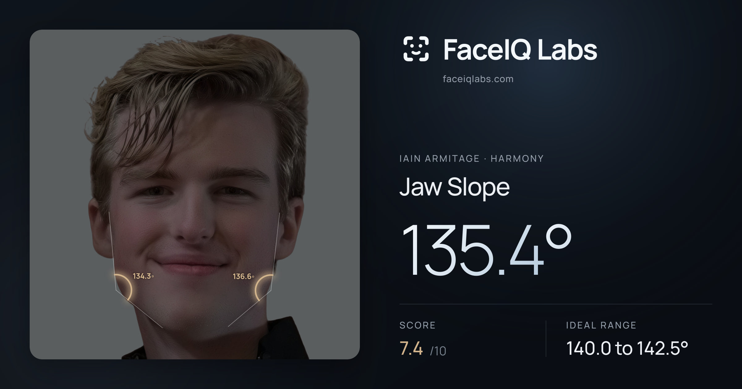 Iain Armitage Jaw Slope: 135.4°, drawn on the photo