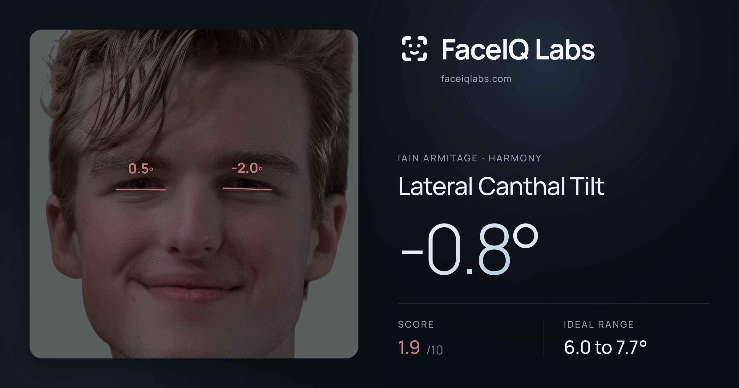 Iain Armitage Lateral Canthal Tilt: -0.8°, drawn on the photo