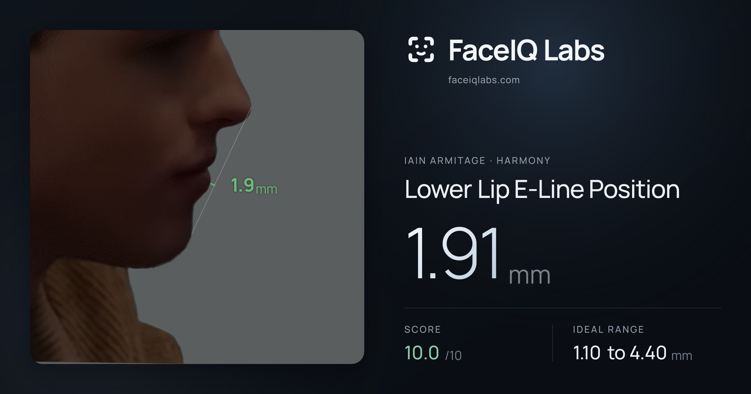 Iain Armitage Lower Lip E-Line Position: 1.91mm, drawn on the photo