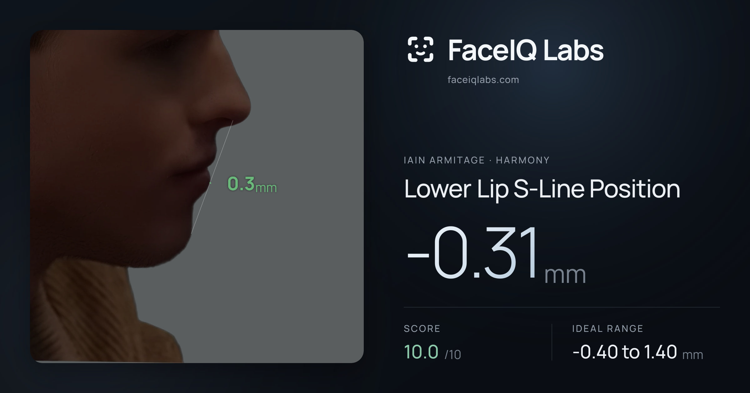 Iain Armitage Lower Lip S-Line Position: -0.31mm, drawn on the photo