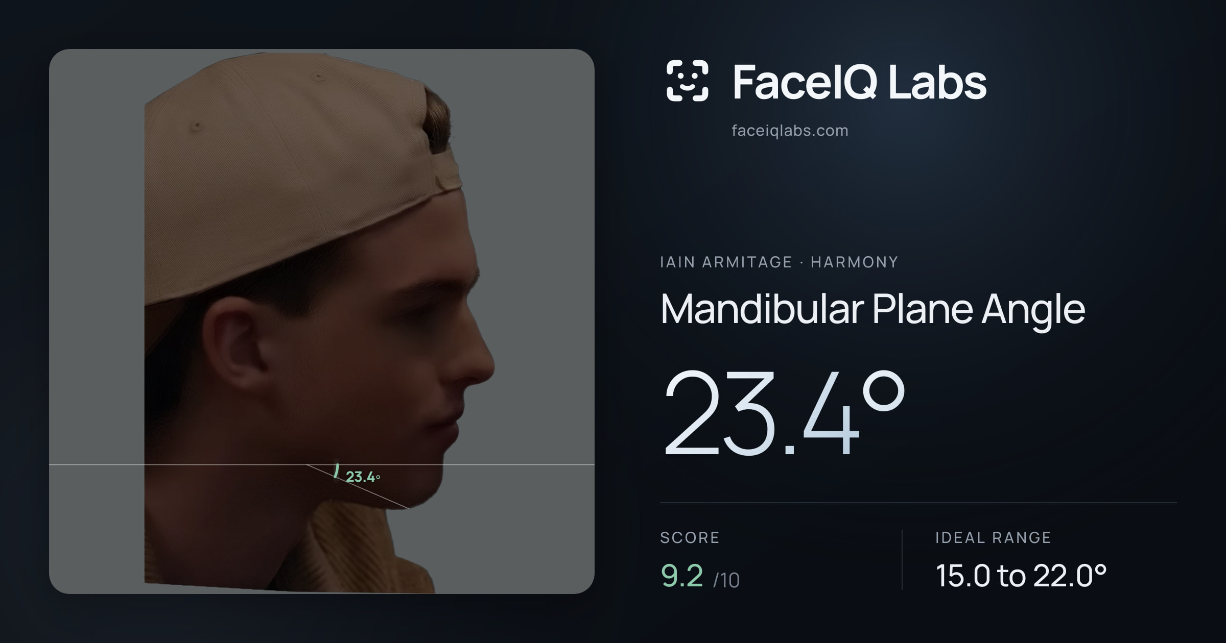Iain Armitage Mandibular Plane Angle: 23.4°, drawn on the photo