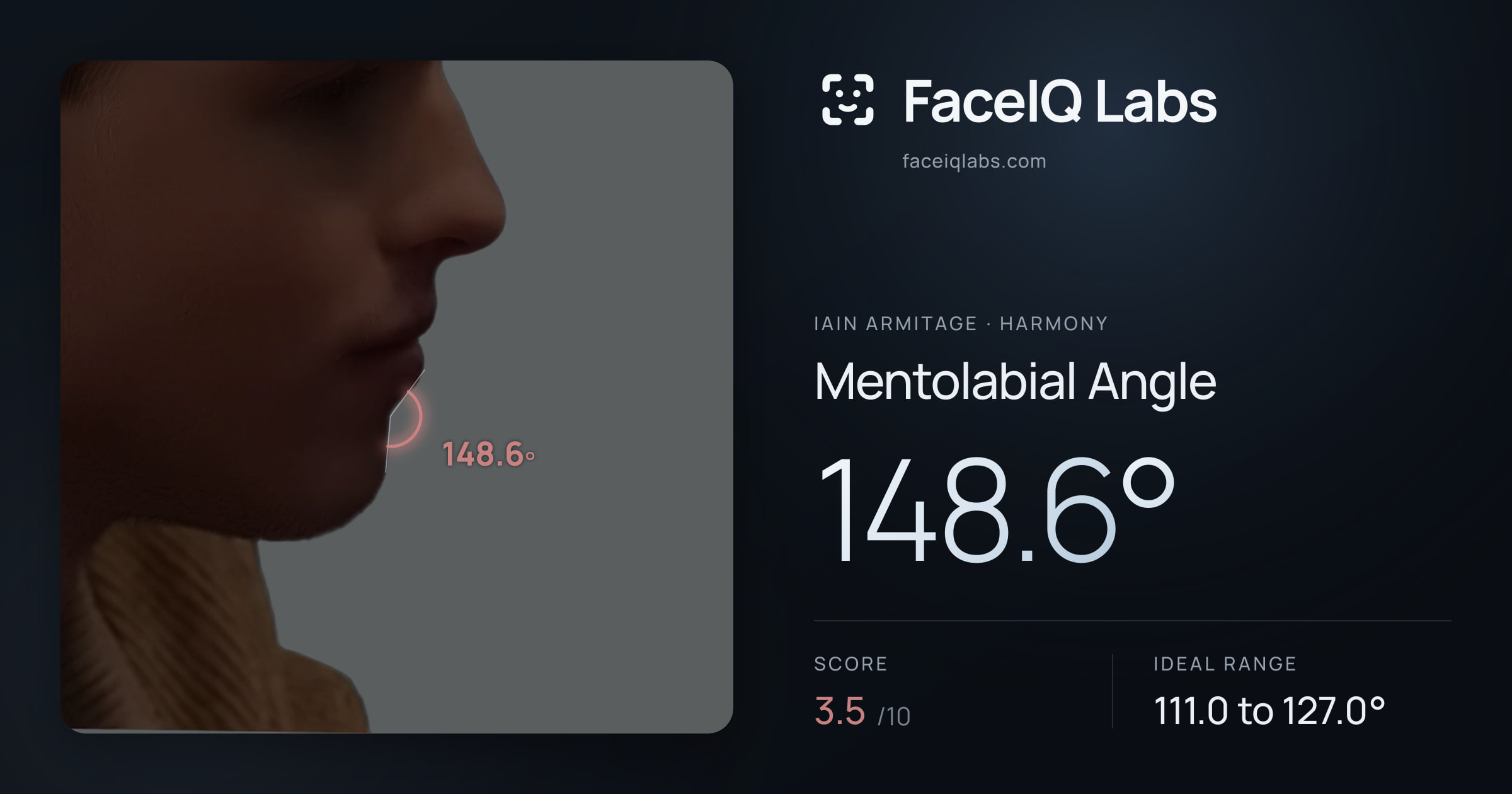 Iain Armitage Mentolabial Angle: 148.6°, drawn on the photo