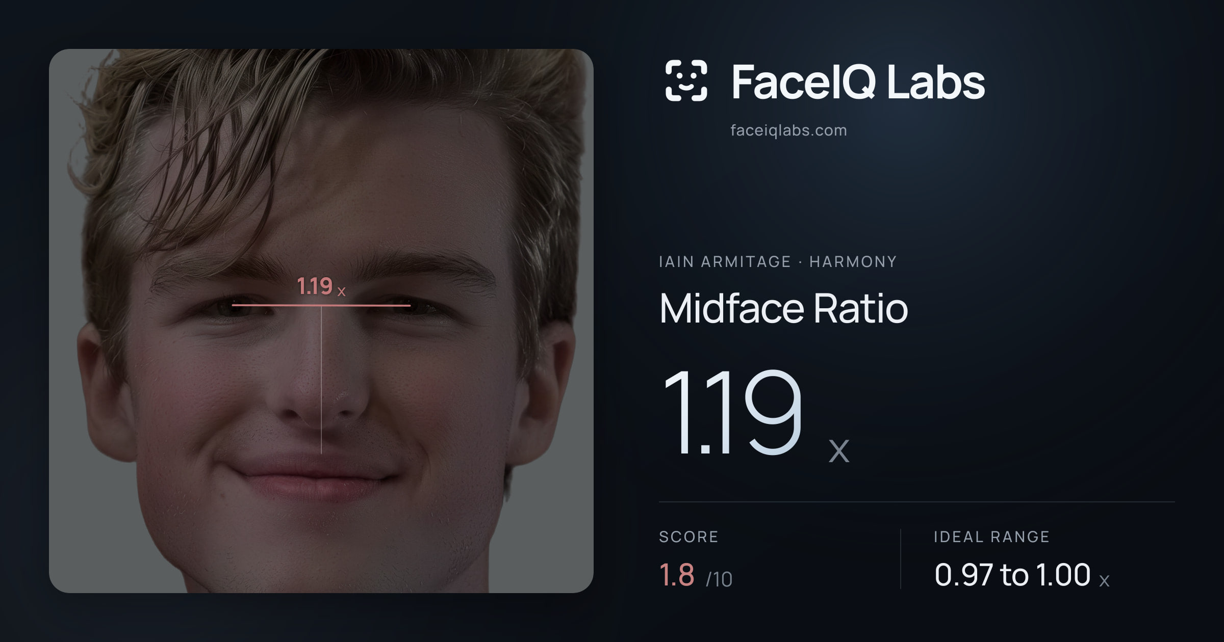 Iain Armitage Midface Ratio: 1.19x, drawn on the photo