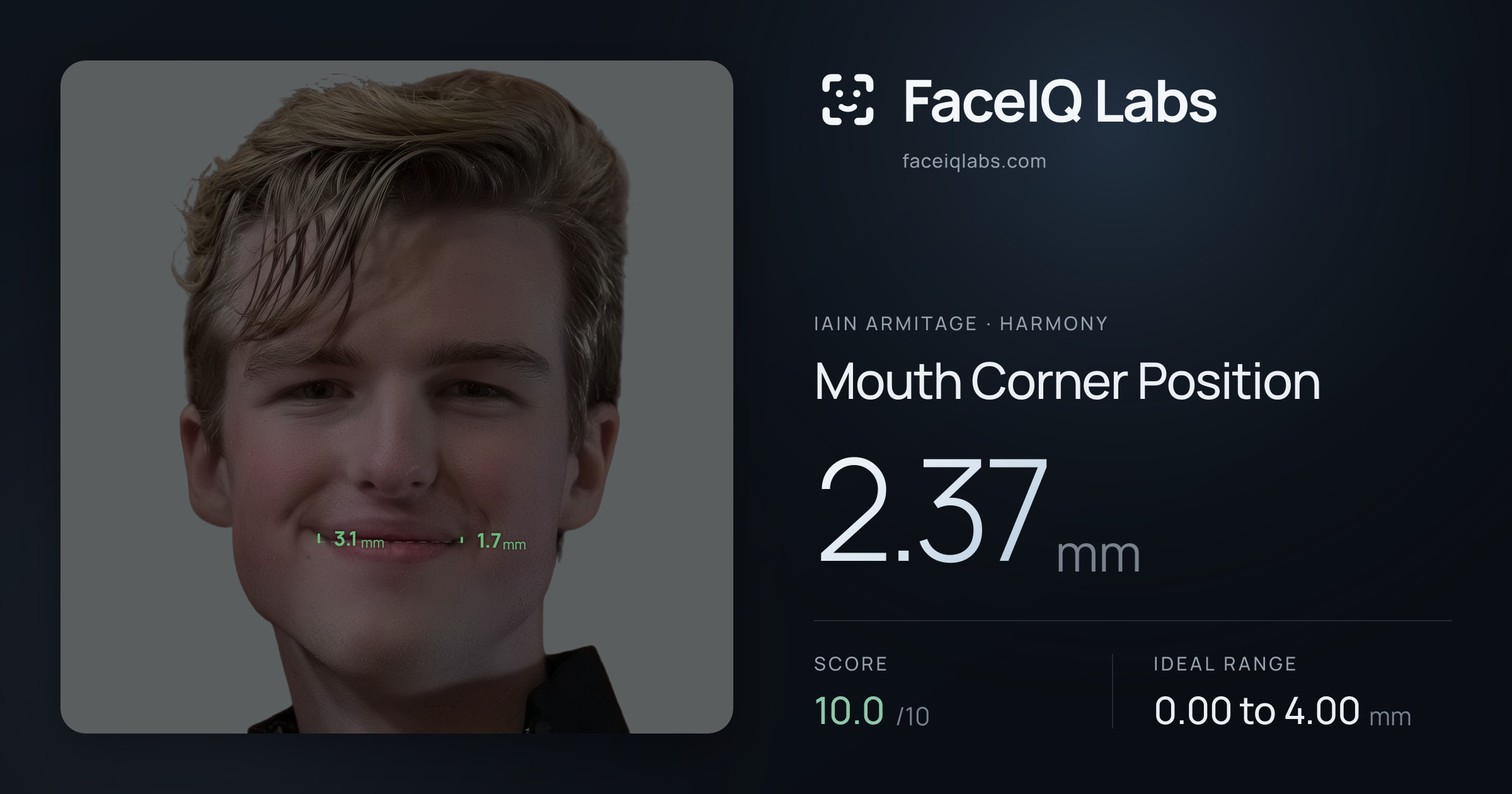 Iain Armitage Mouth Corner Position: 2.37mm, drawn on the photo
