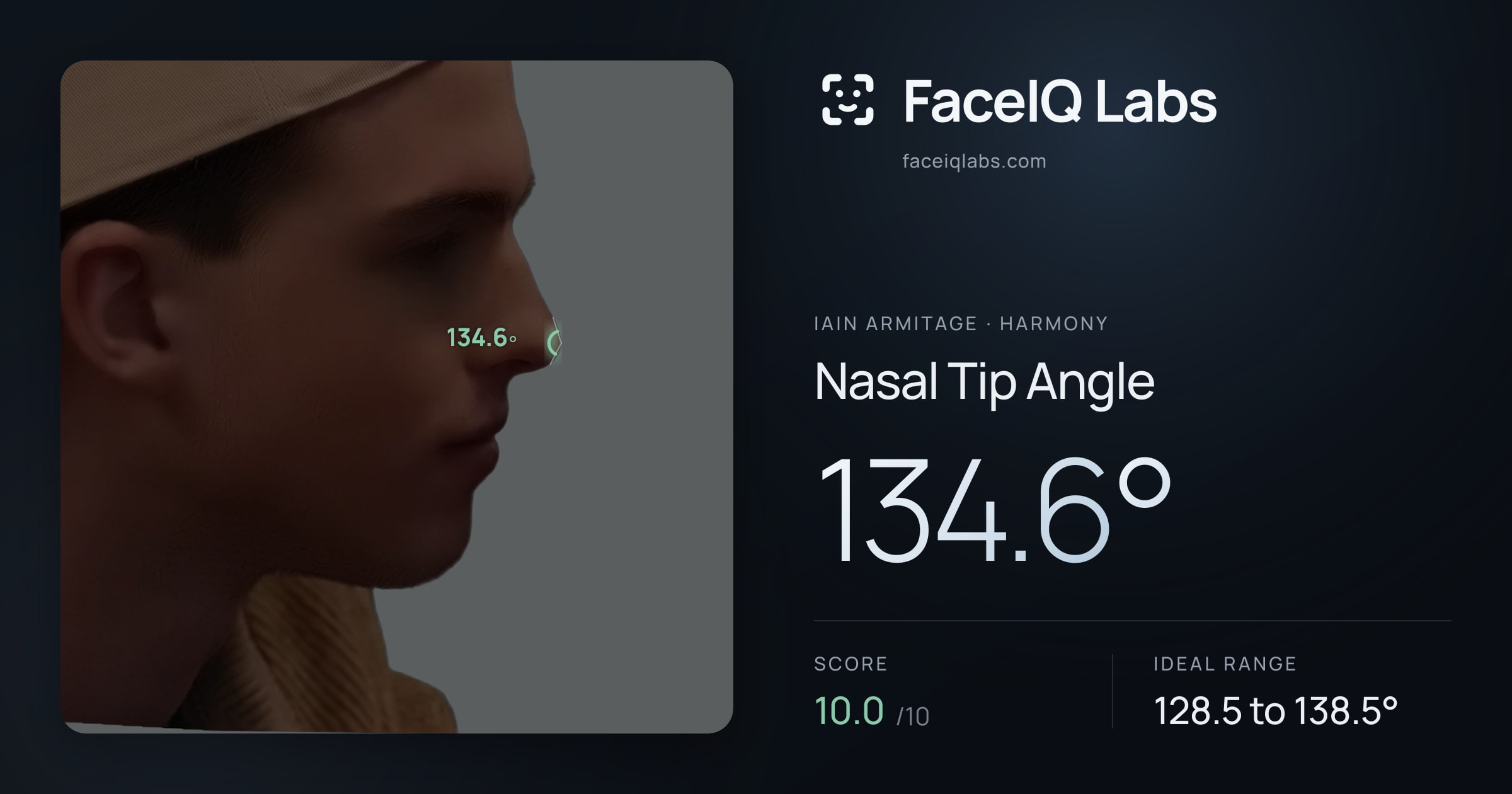 Iain Armitage Nasal Tip Angle: 134.6°, drawn on the photo