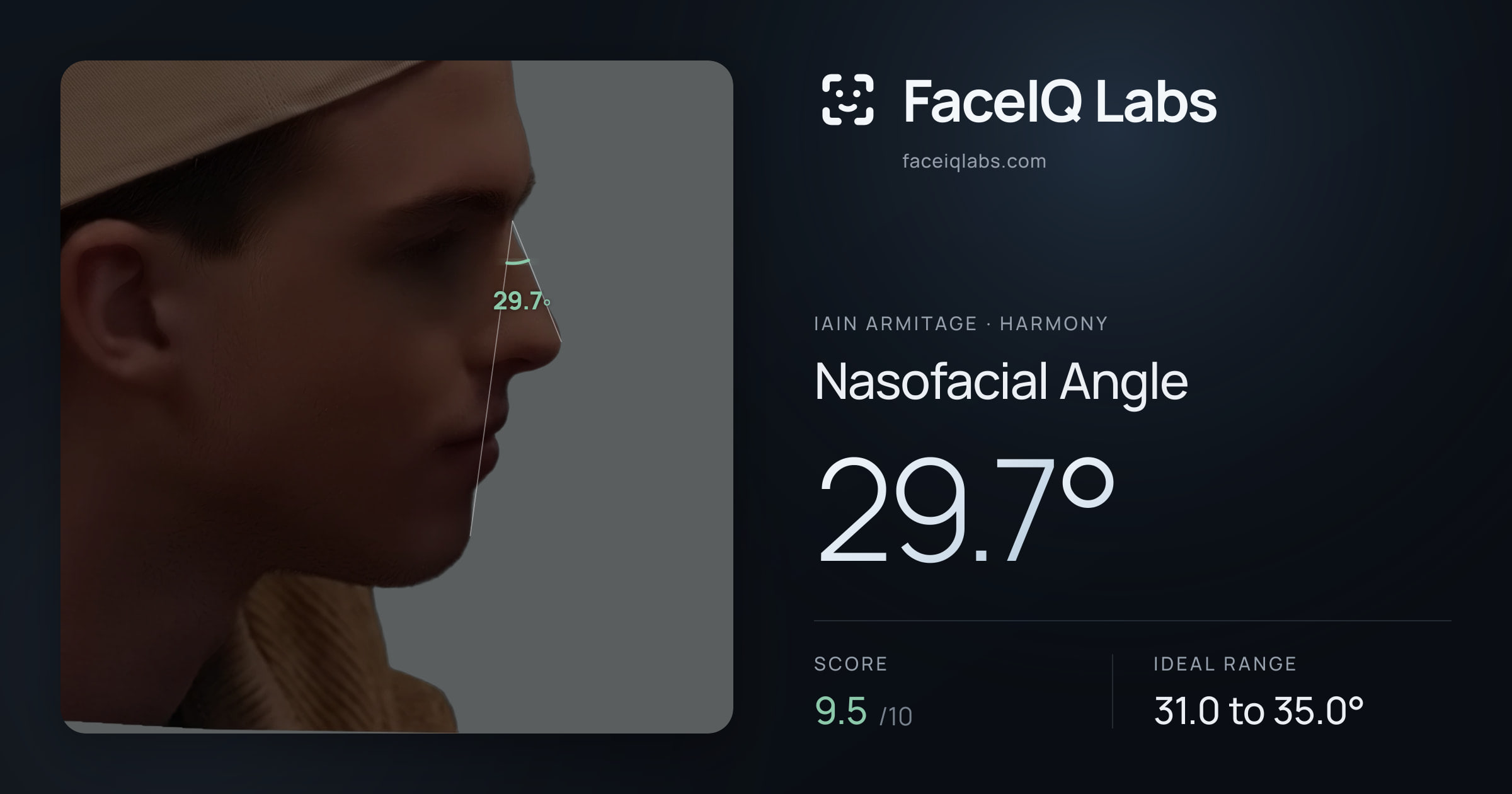 Iain Armitage Nasofacial Angle: 29.7°, drawn on the photo