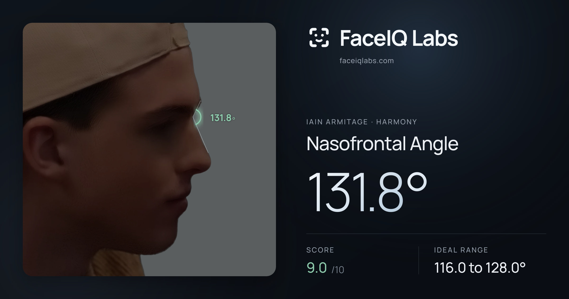 Iain Armitage Nasofrontal Angle: 131.8°, drawn on the photo