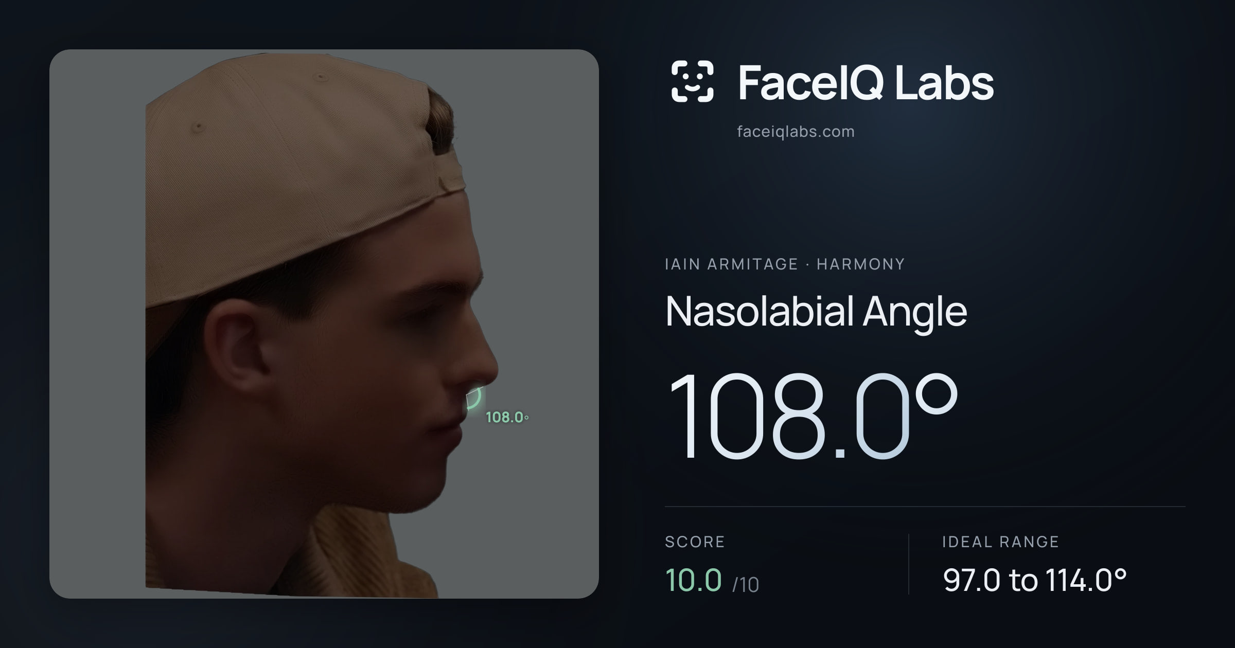 Iain Armitage Nasolabial Angle: 108.0°, drawn on the photo