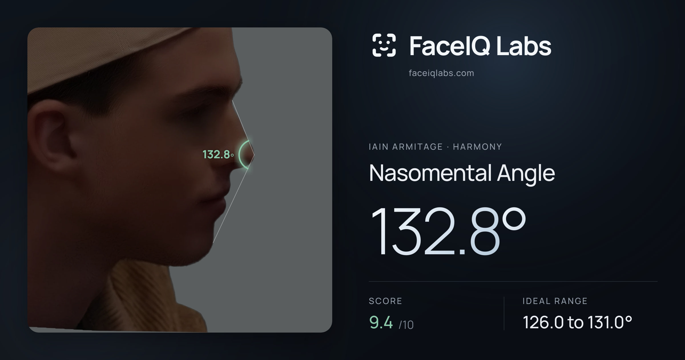 Iain Armitage Nasomental Angle: 132.8°, drawn on the photo