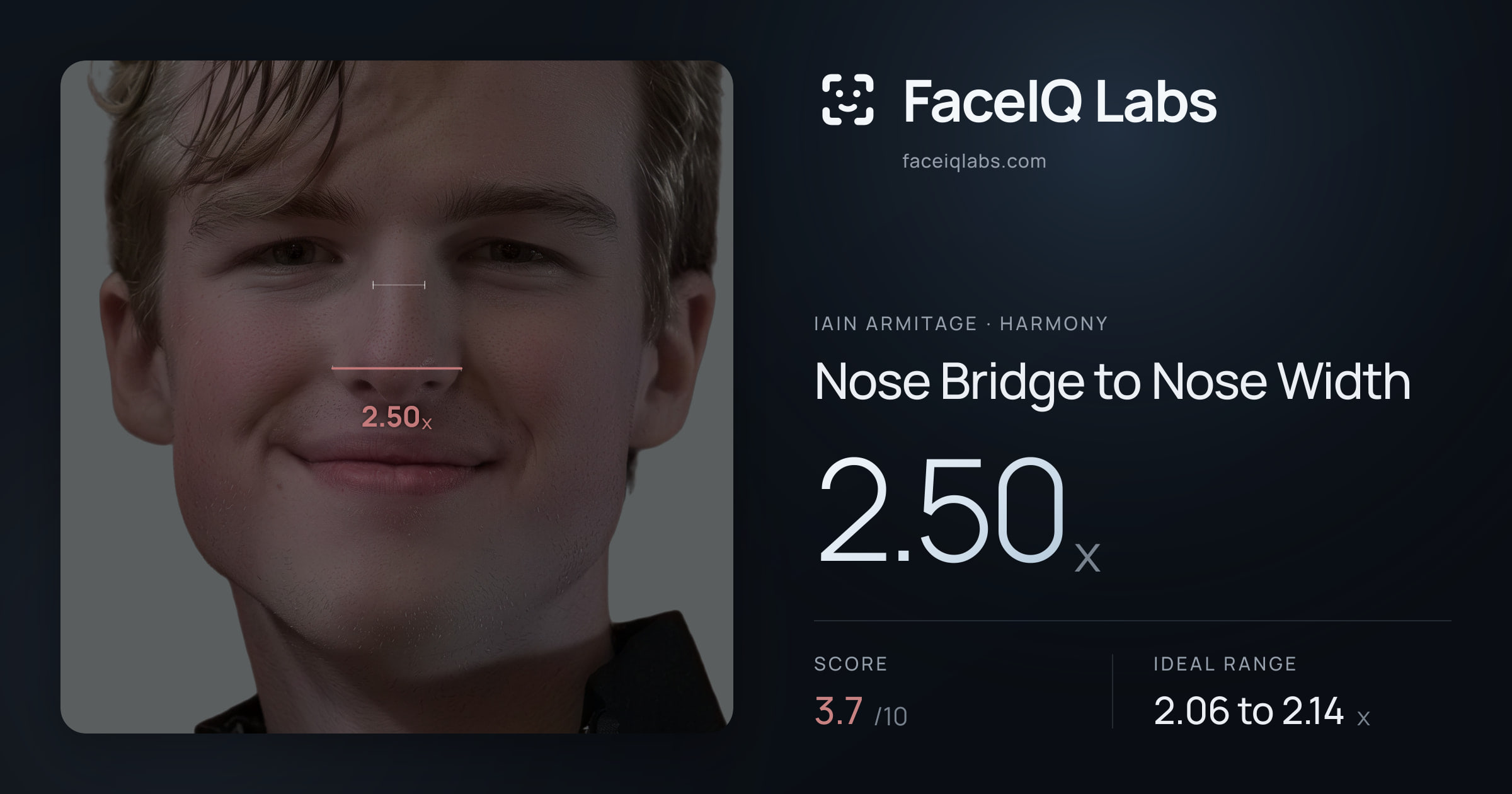 Iain Armitage Nose Bridge to Nose Width: 2.50x, drawn on the photo
