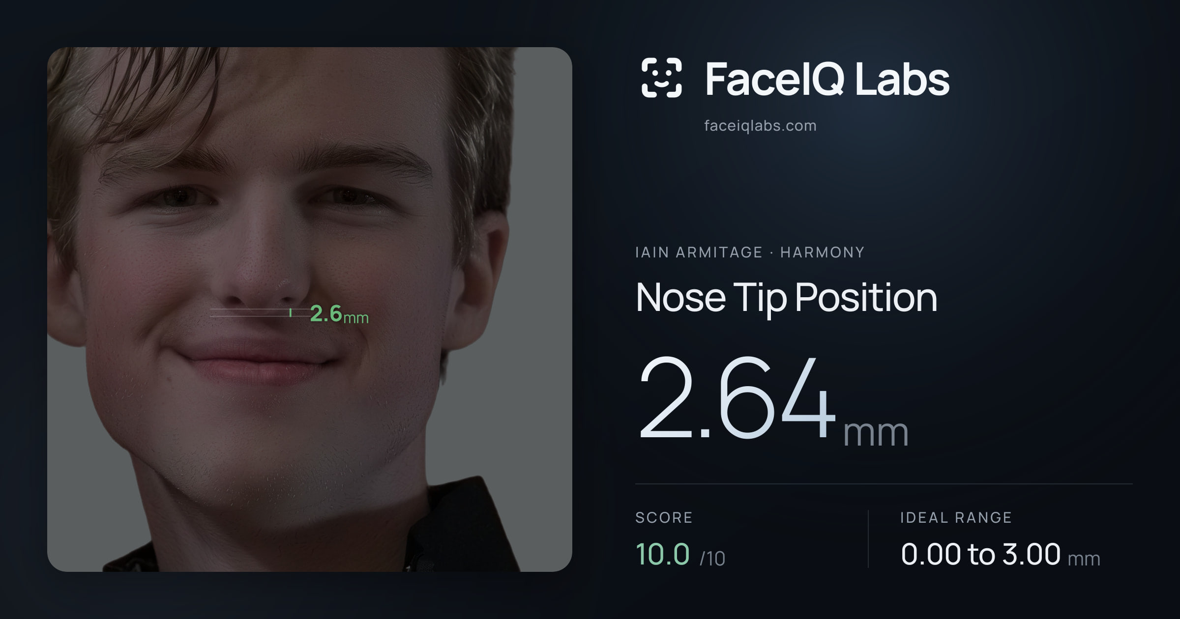 Iain Armitage Nose Tip Position: 2.64mm, drawn on the photo