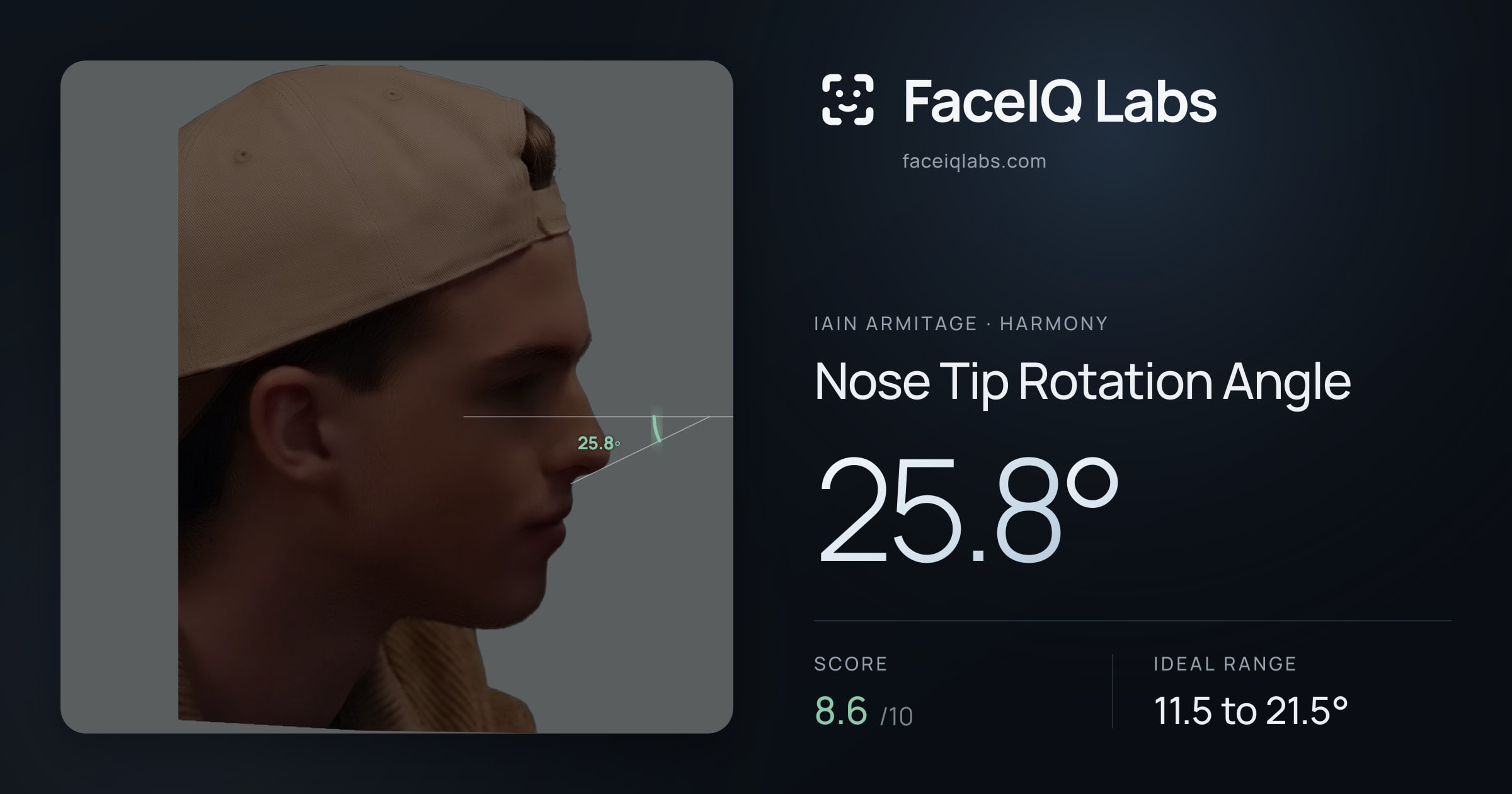 Iain Armitage Nose Tip Rotation Angle: 25.8°, drawn on the photo