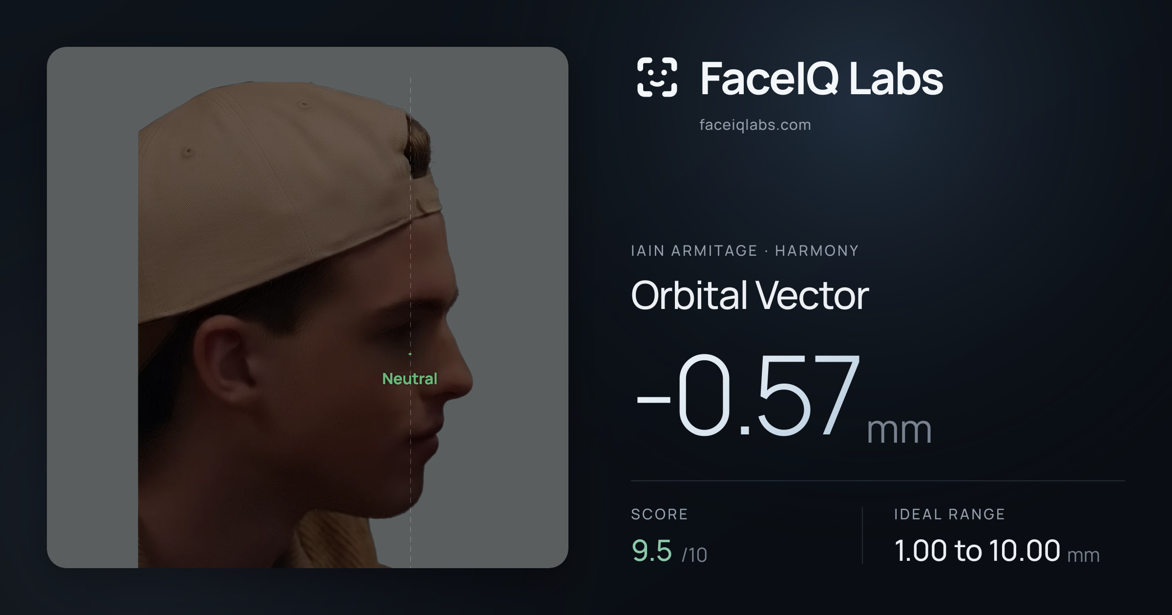 Iain Armitage Orbital Vector: -0.57mm, drawn on the photo