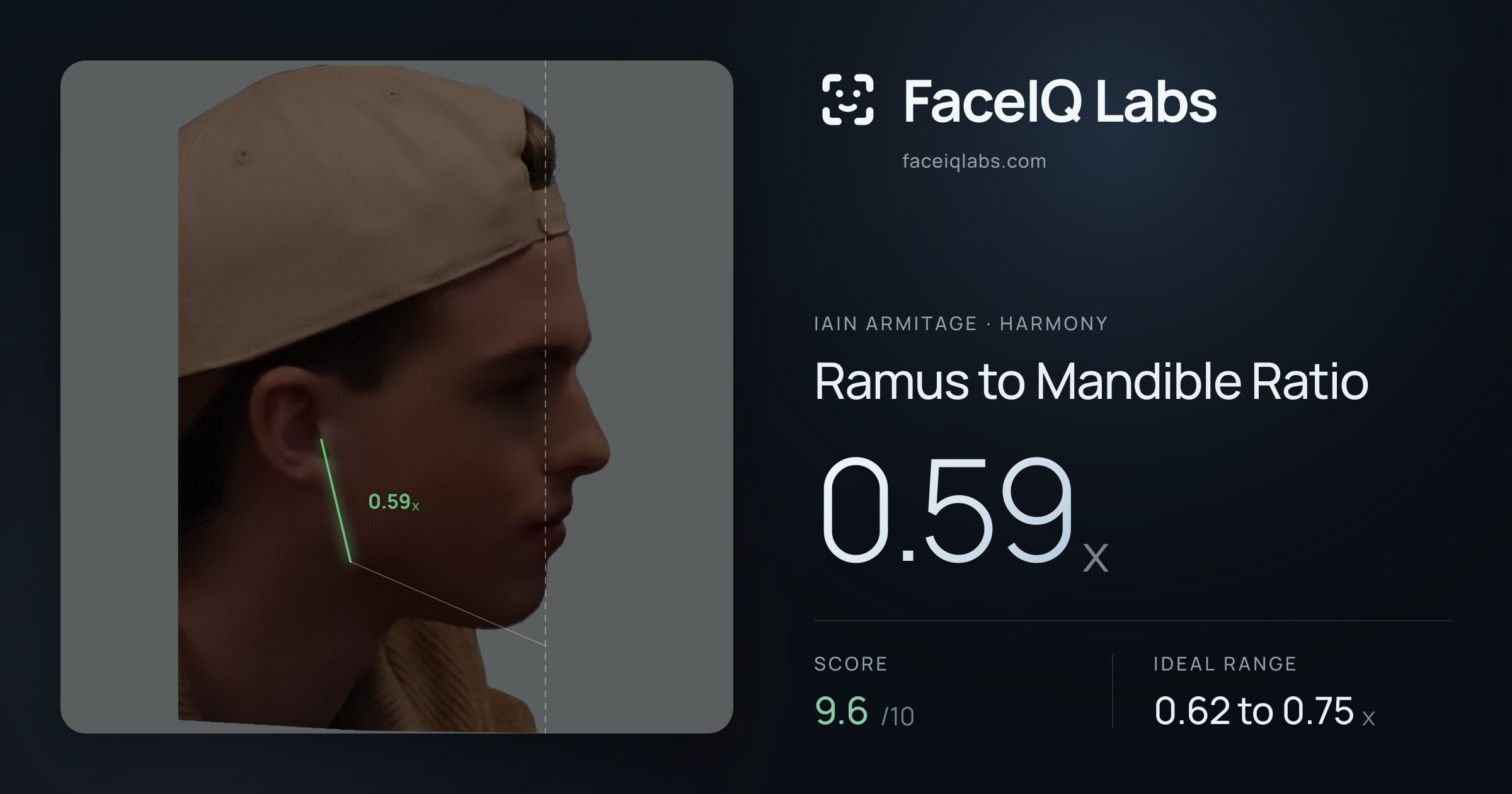Iain Armitage Ramus to Mandible Ratio: 0.59x, drawn on the photo
