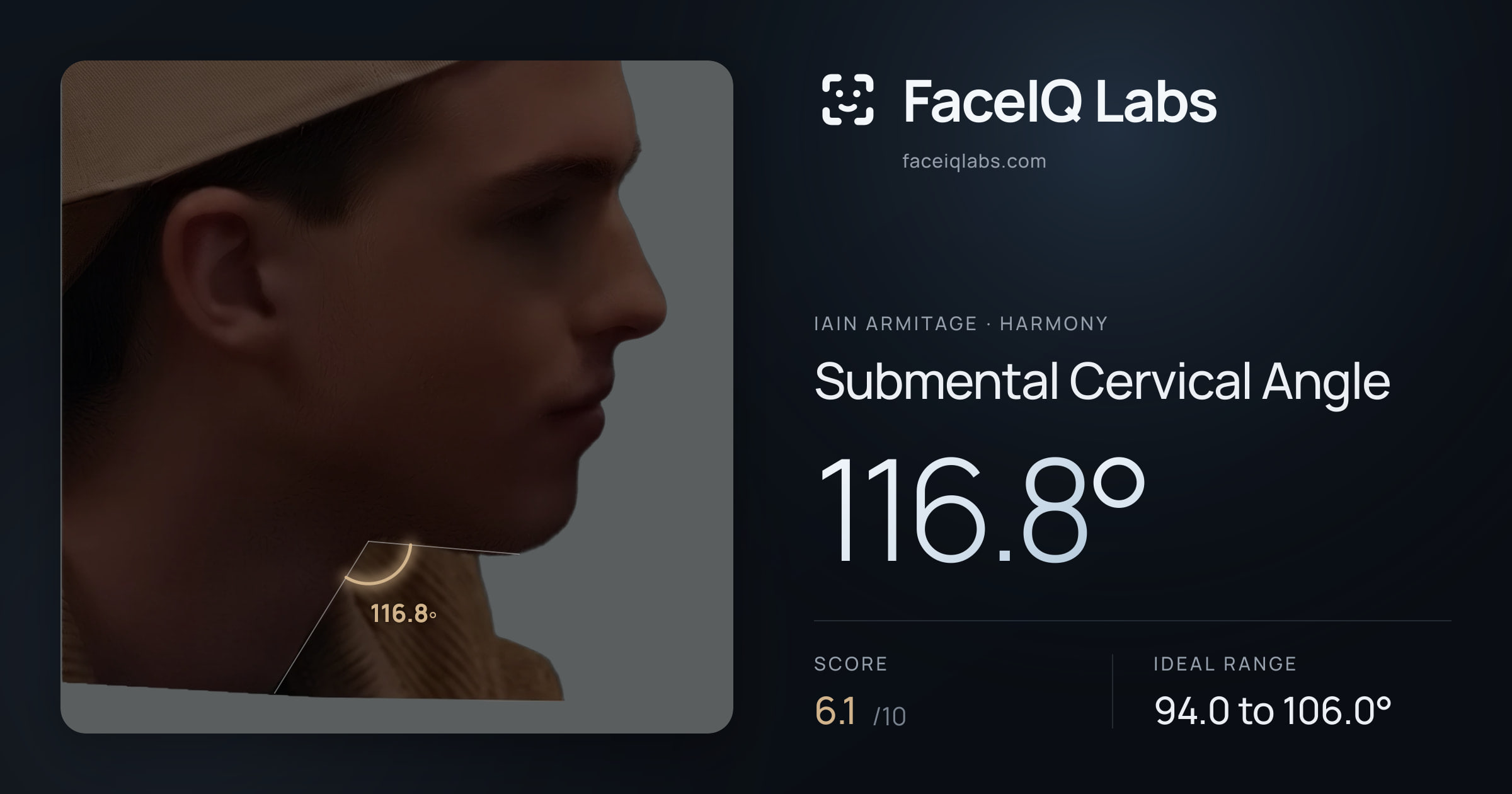 Iain Armitage Submental Cervical Angle: 116.8°, drawn on the photo