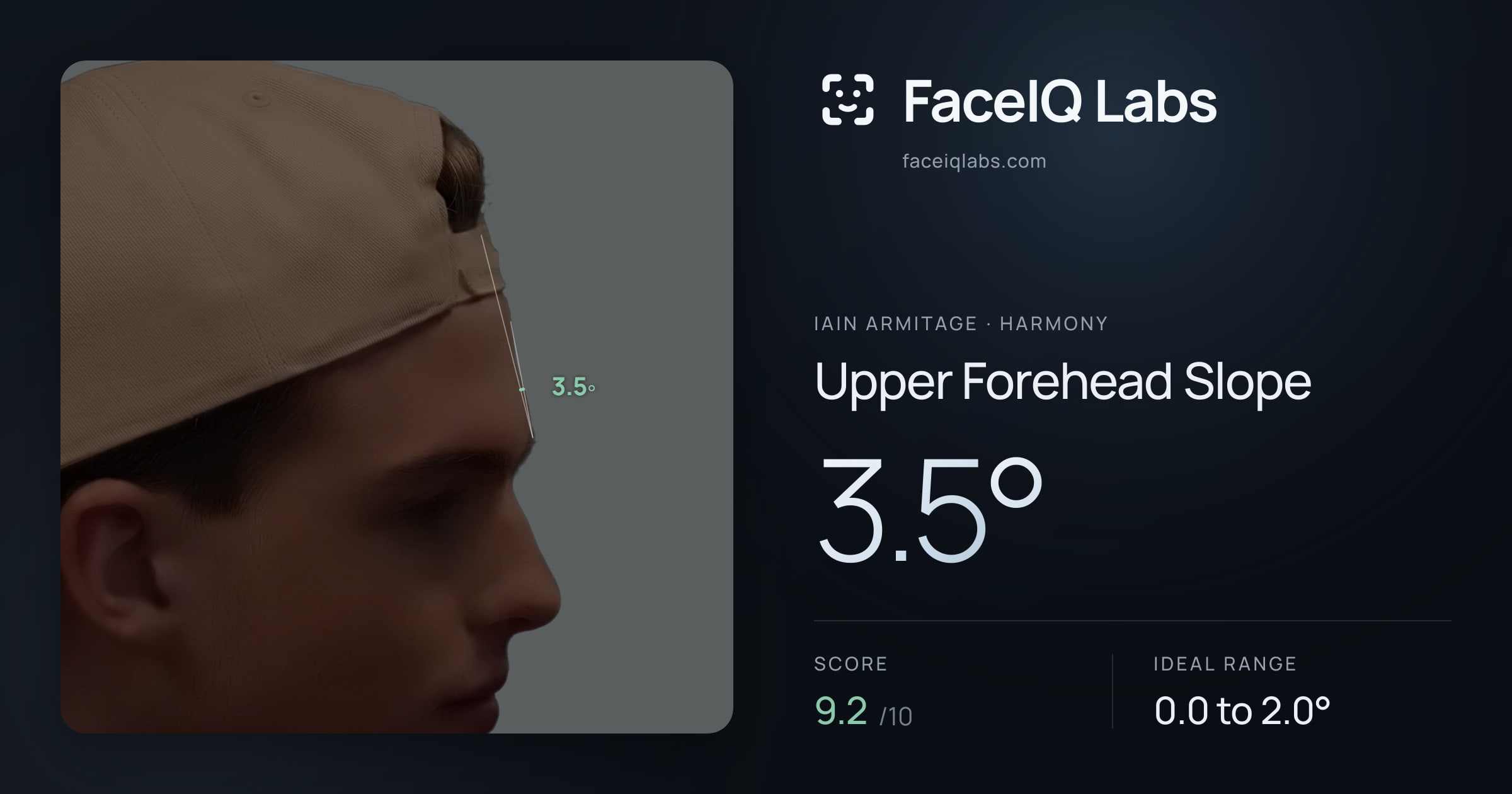 Iain Armitage Upper Forehead Slope: 3.5°, drawn on the photo