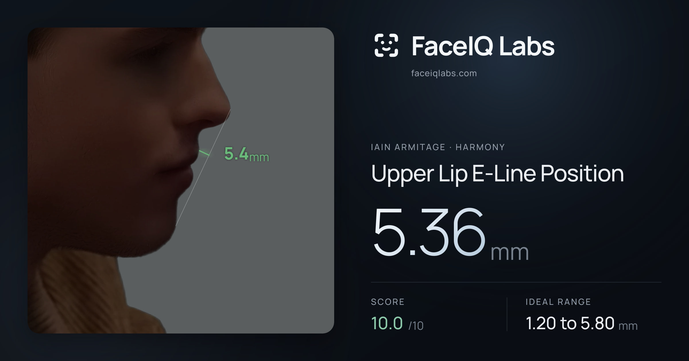 Iain Armitage Upper Lip E-Line Position: 5.36mm, drawn on the photo