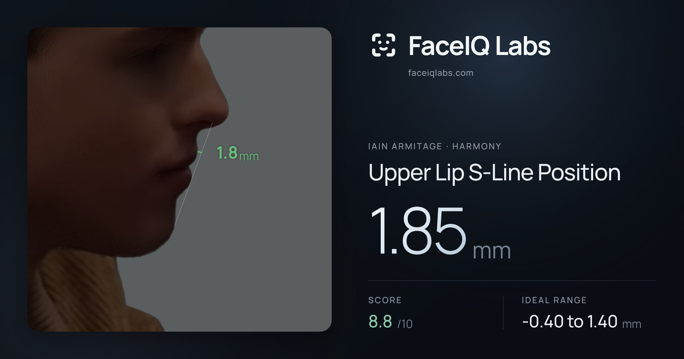 Iain Armitage Upper Lip S-Line Position: 1.85mm, drawn on the photo
