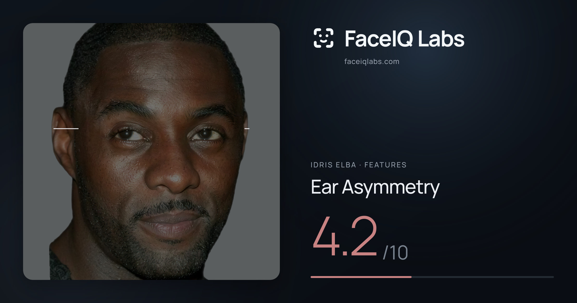 Idris Elba Ear Asymmetry: 4.2/10, drawn on the photo