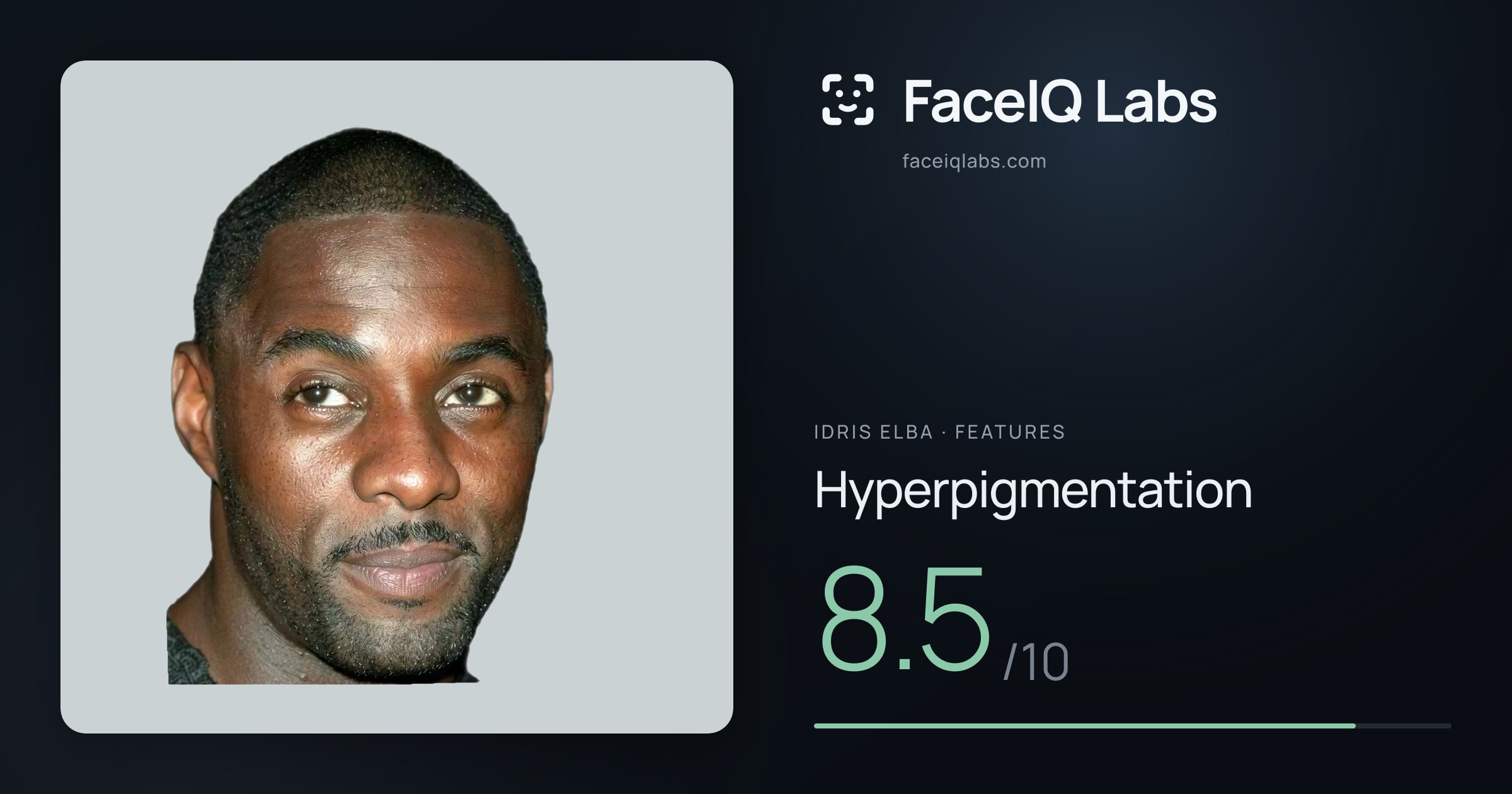 Idris Elba Hyperpigmentation: 8.5/10, drawn on the photo