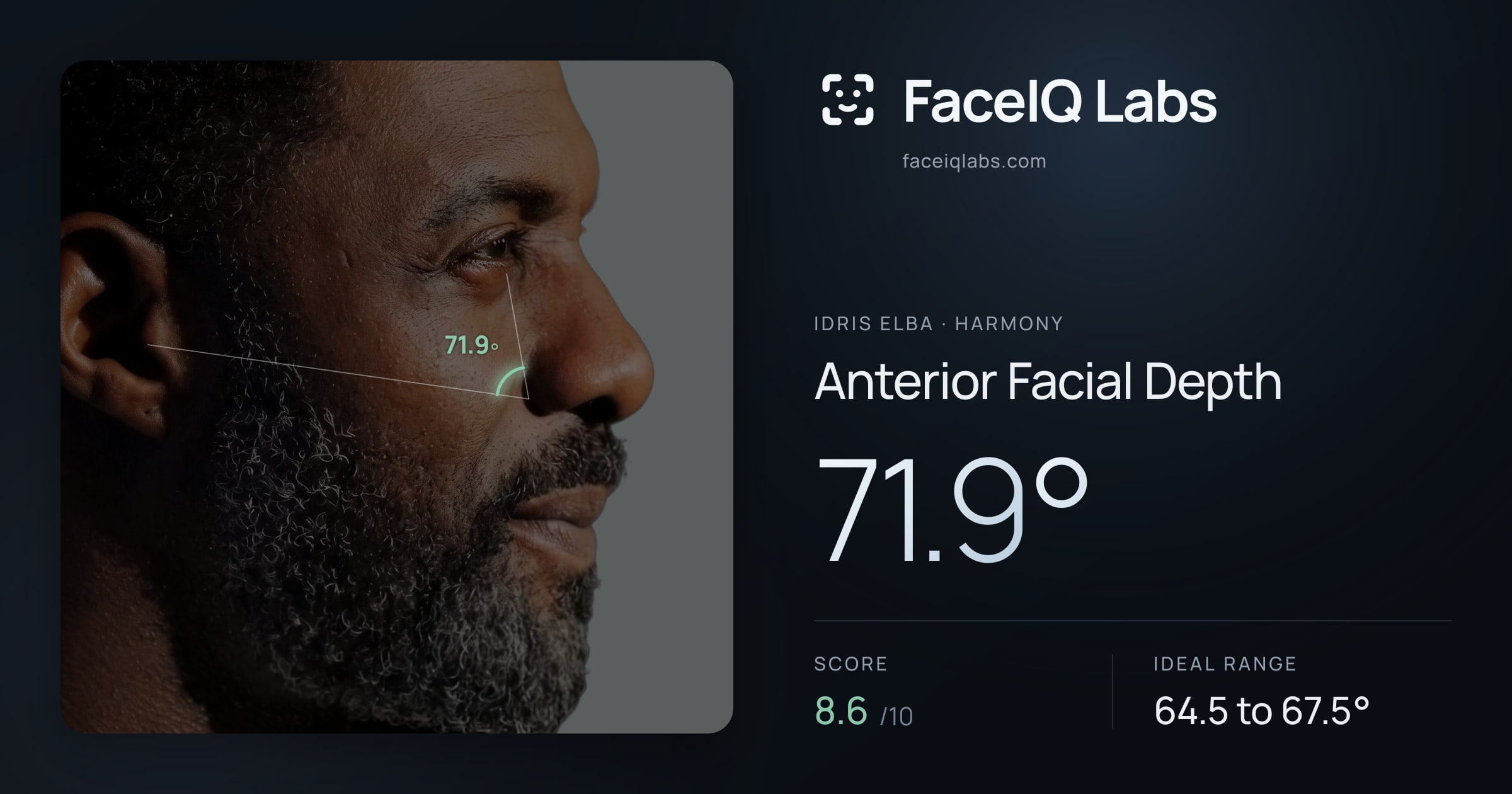 Idris Elba Anterior Facial Depth: 71.9°, drawn on the photo