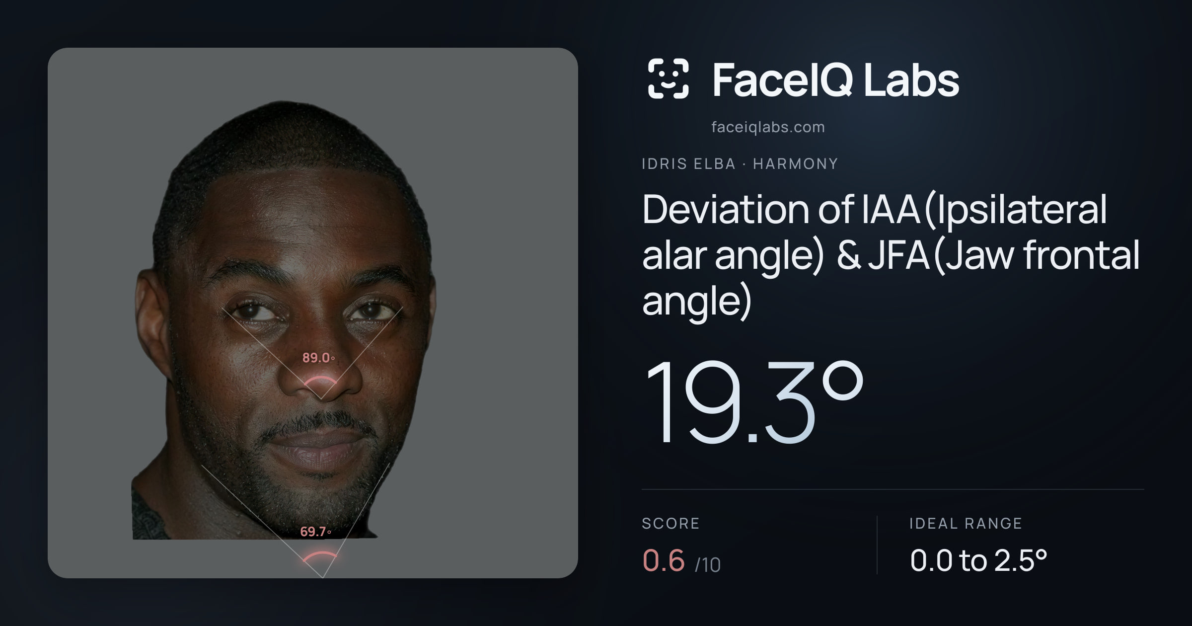 Idris Elba Deviation of IAA(Ipsilateral alar angle) & JFA(Jaw frontal angle): 19.3°, drawn on the photo