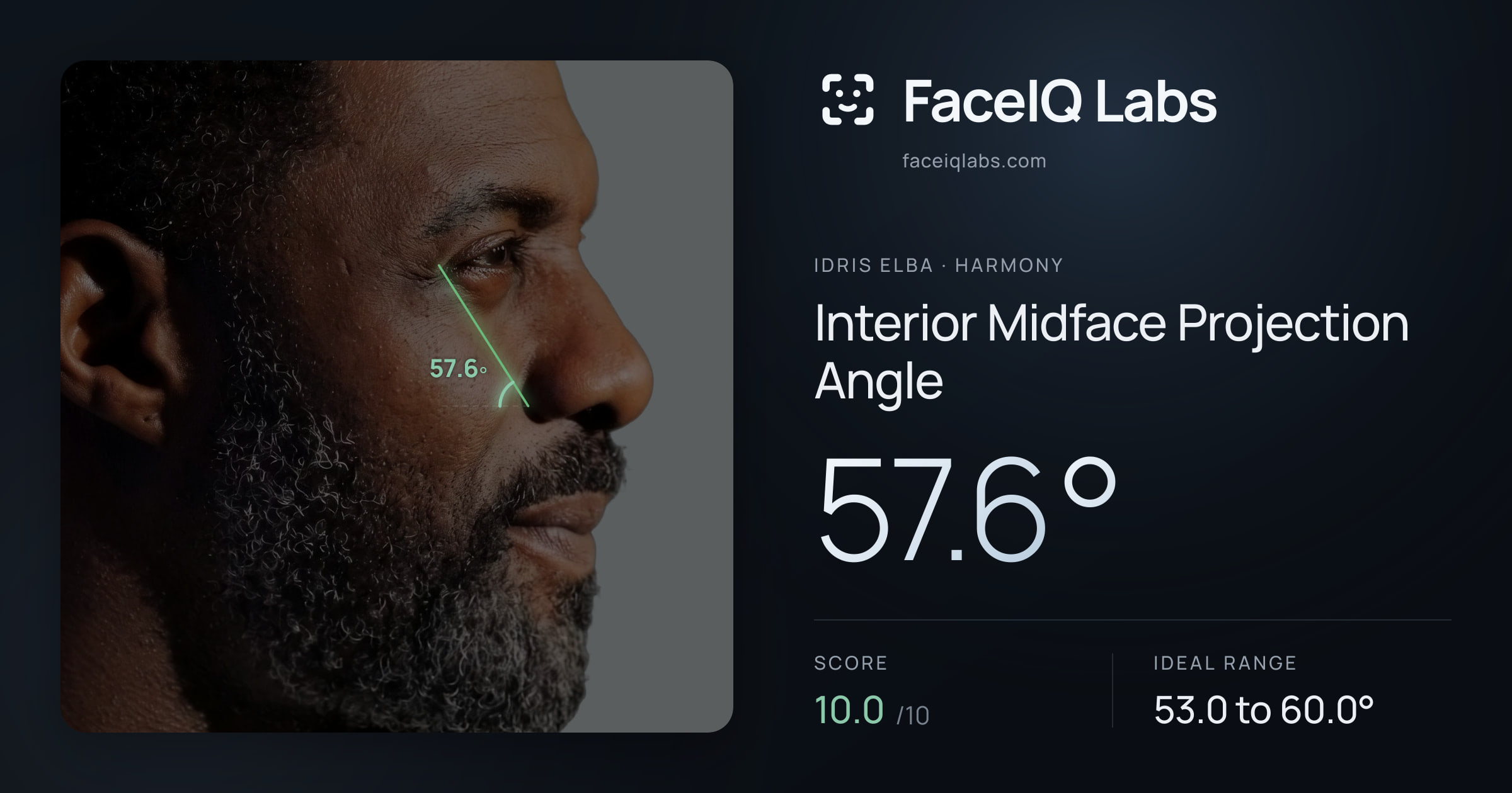 Idris Elba Interior Midface Projection Angle: 57.6°, drawn on the photo