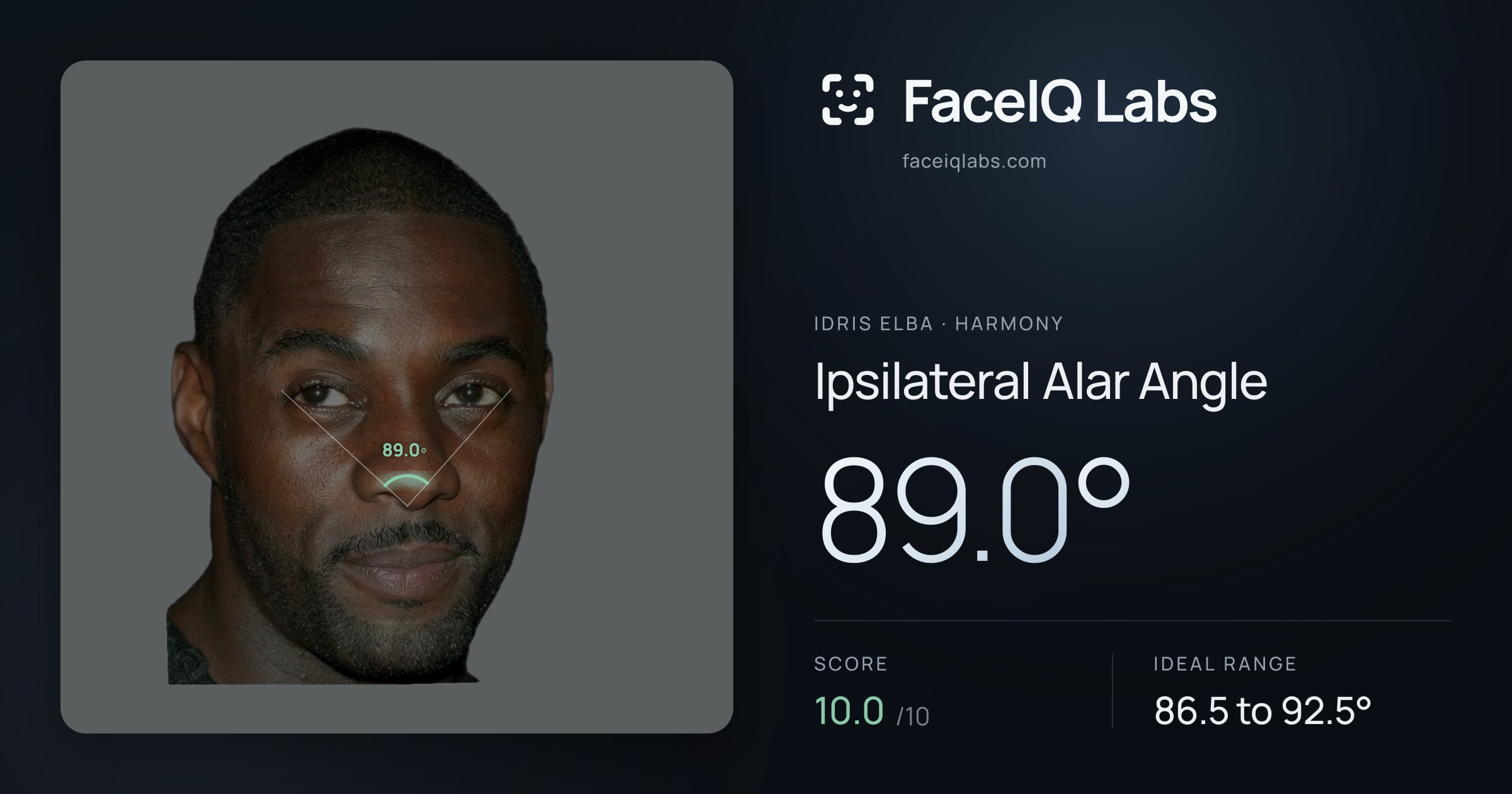 Idris Elba Ipsilateral Alar Angle: 89.0°, drawn on the photo